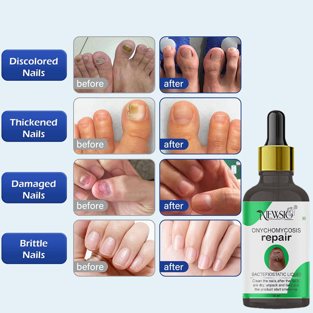 Newsio Manicure & Pedicure Kit ( Pack of 1 )