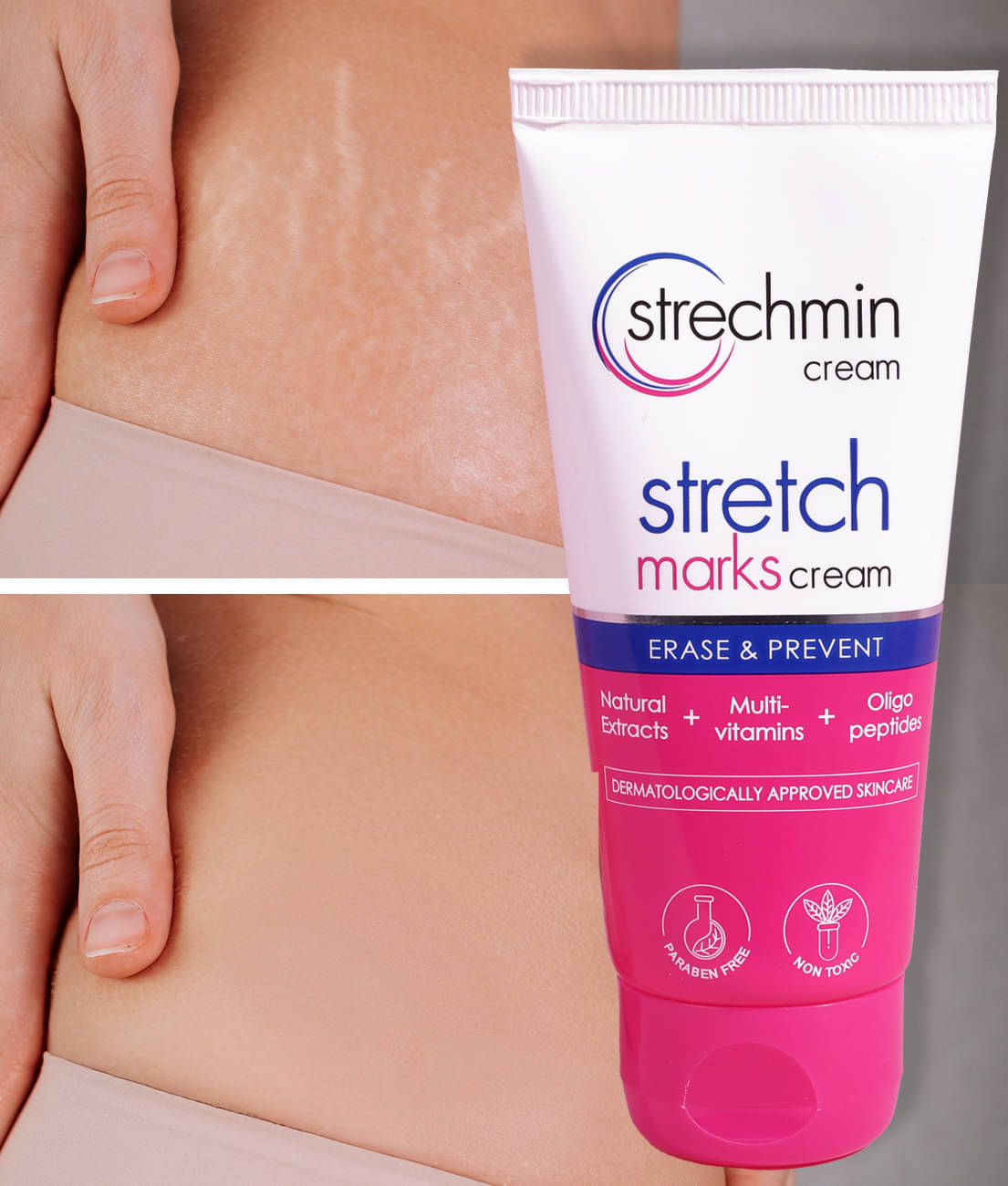     			Strechmin Stretch Marks Cream with Vitamin E Oil for women 50g | Non-Toxic, Paraben-Free