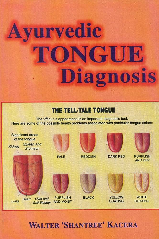     			Ayurvedic Tongue Diagnosis