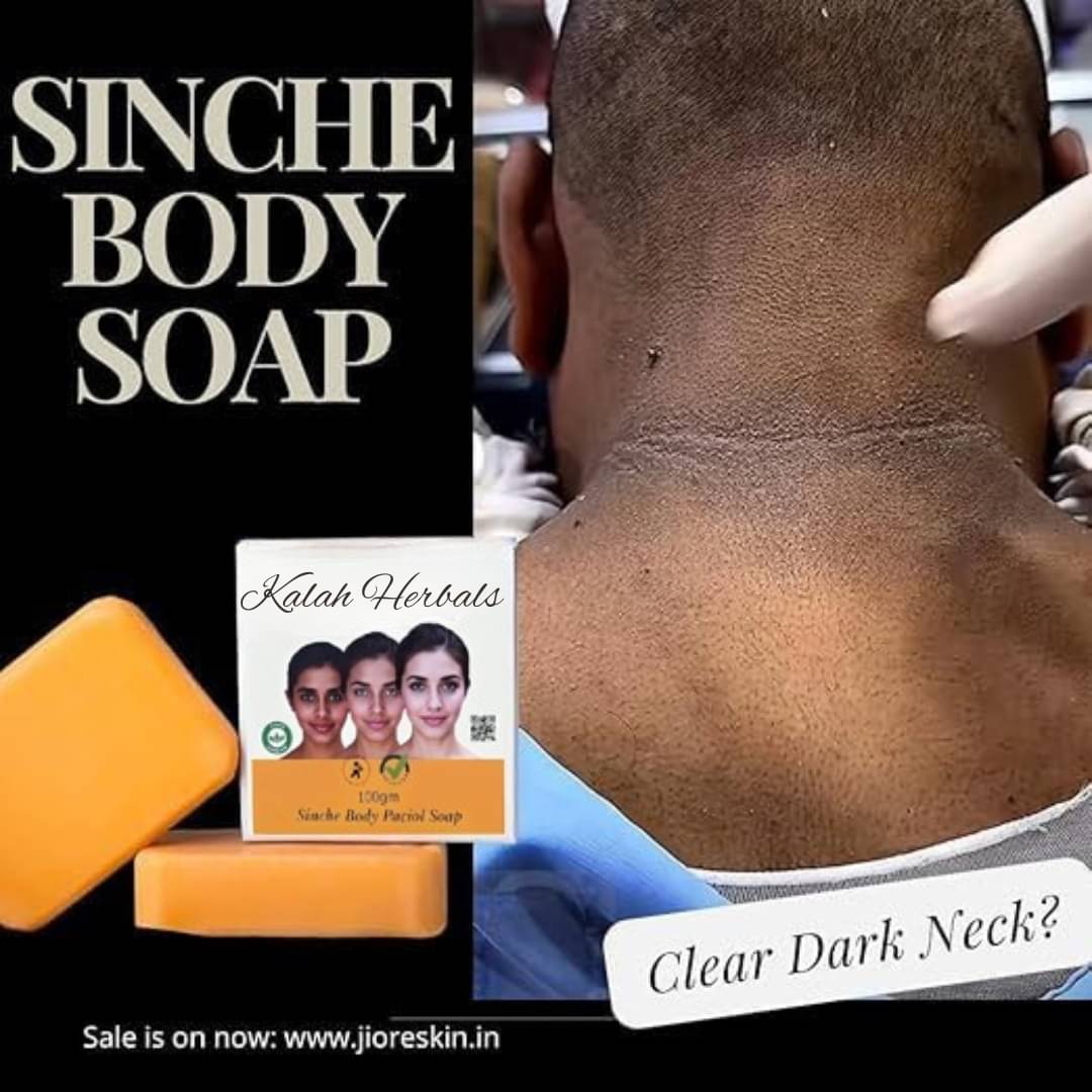 kalah herbals Beauty Jiore skincare sinche Body Soap Bathing Bar for Normal Skin ( Pack of 3 ) kalah herbals Beauty Jiore skincare sinche Body Soap Bathing Bar for Normal Skin ( Pack of 3 )