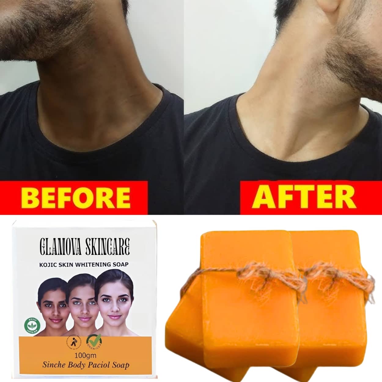 LA ORGANO Glutathione Charcoal Skin Lightening & Brightening Bathing Soap  300 g Pack of 3