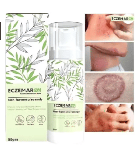 Treszo Moisturizer All Skin Type Aloe Vera ( 50 gm )