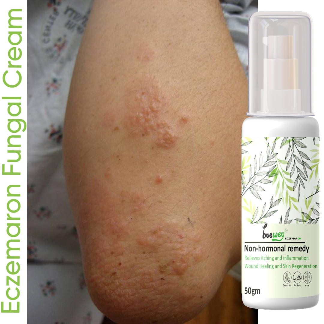     			BUEWEY Moisturizer All Skin Type Aloe Vera ( 50 gm )