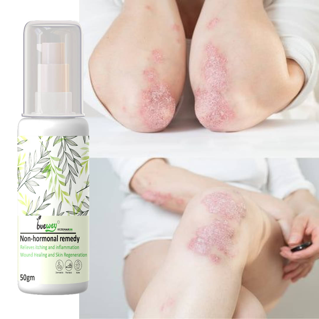     			BUEWEY Moisturizer All Skin Type Aloe Vera ( 50 gm )
