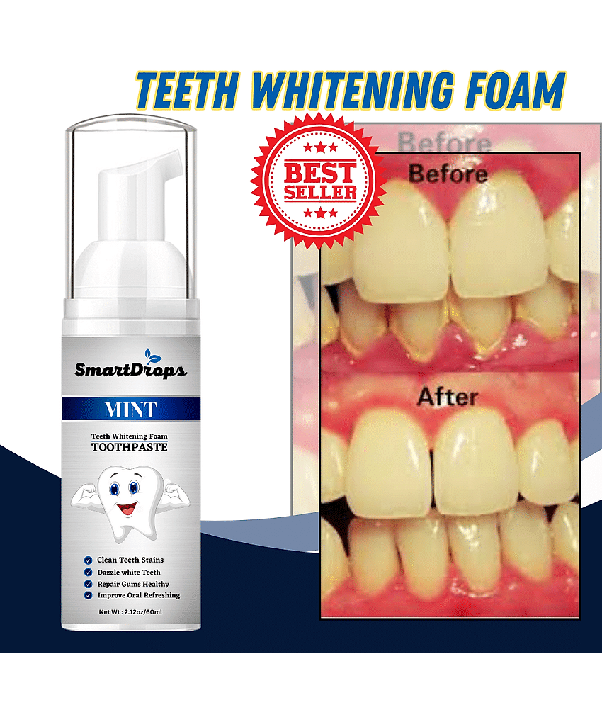 Smartdrops Teeth Whitening Kit 60 Smartdrops Teeth Whitening Kit 60