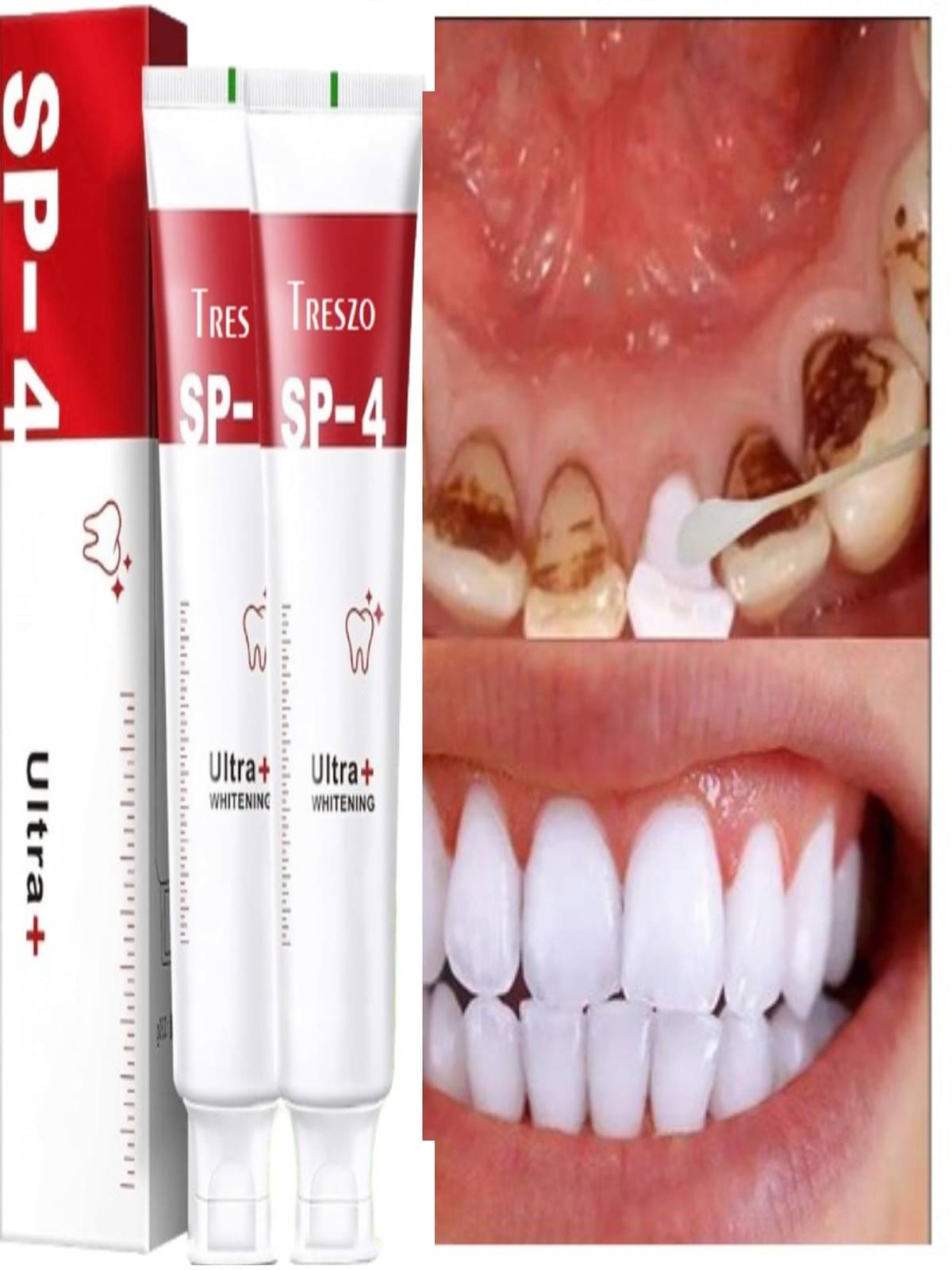 Treszo Whitening Toothpaste Pack of 2 Treszo Whitening Toothpaste Pack of 2