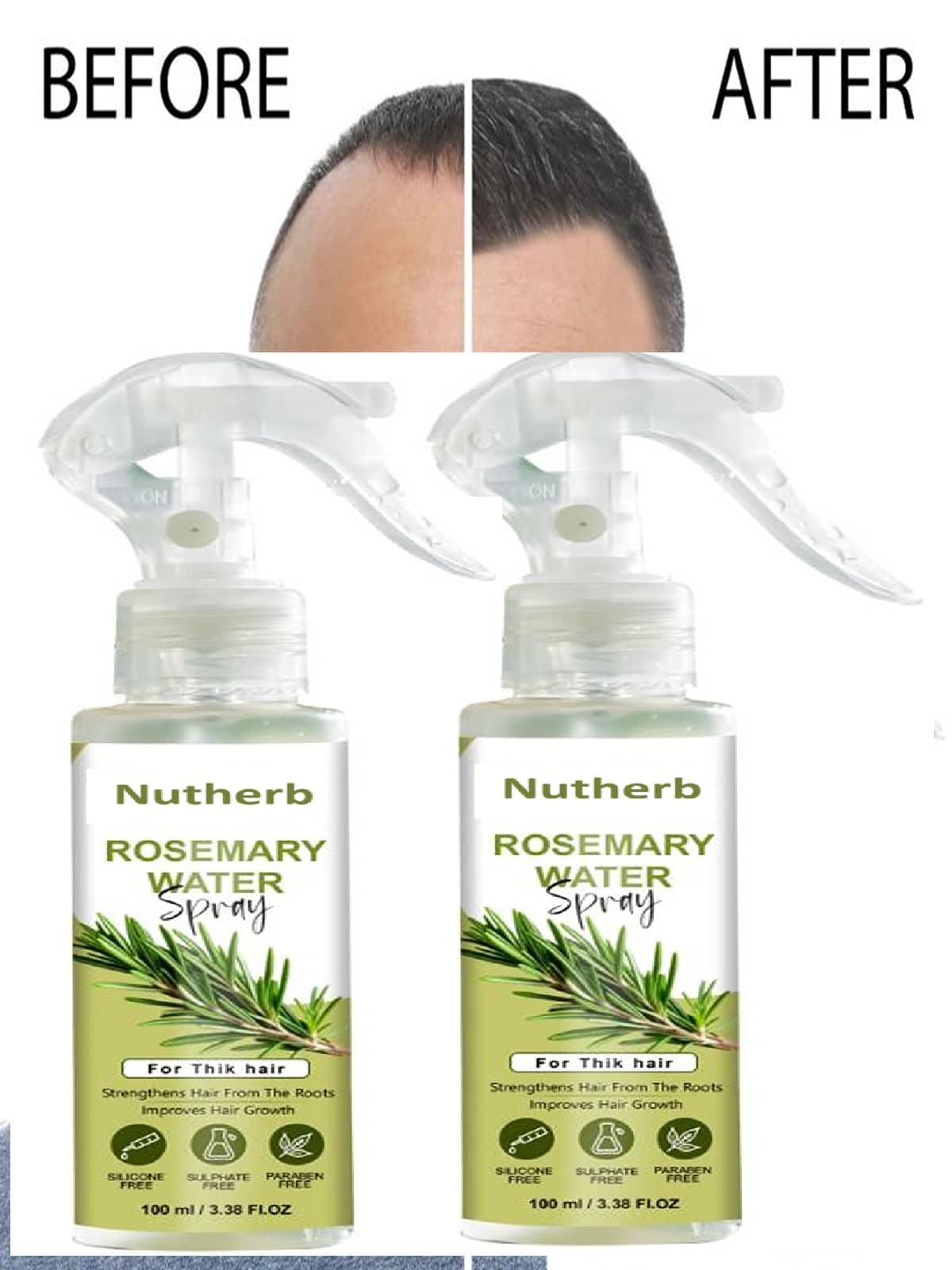 Treszo Rosemary Hair Growth Hair Serum 100 mL Pack of 2