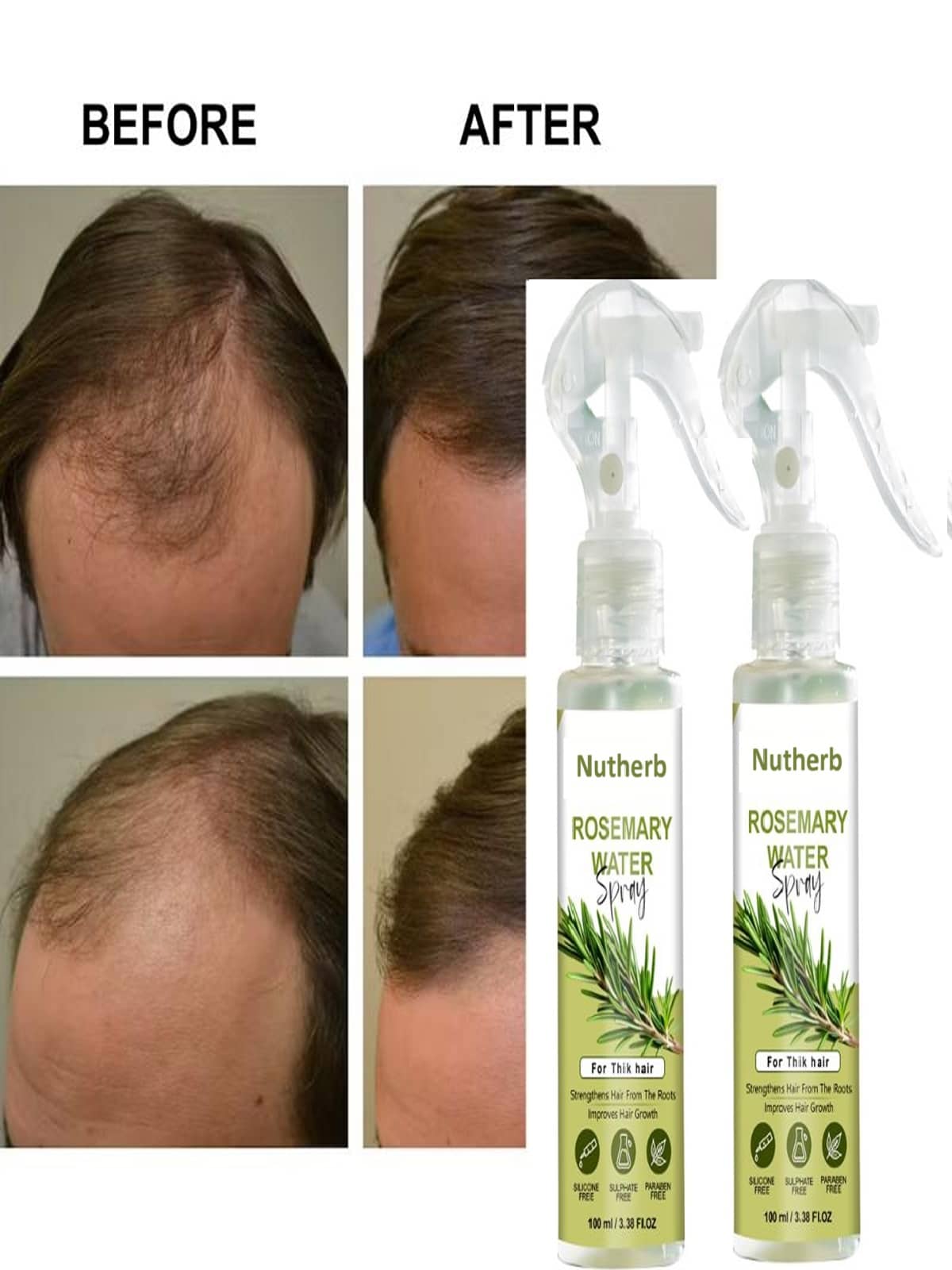 Treszo Rosemary Hair Growth Hair Serum 100 mL Pack of 2