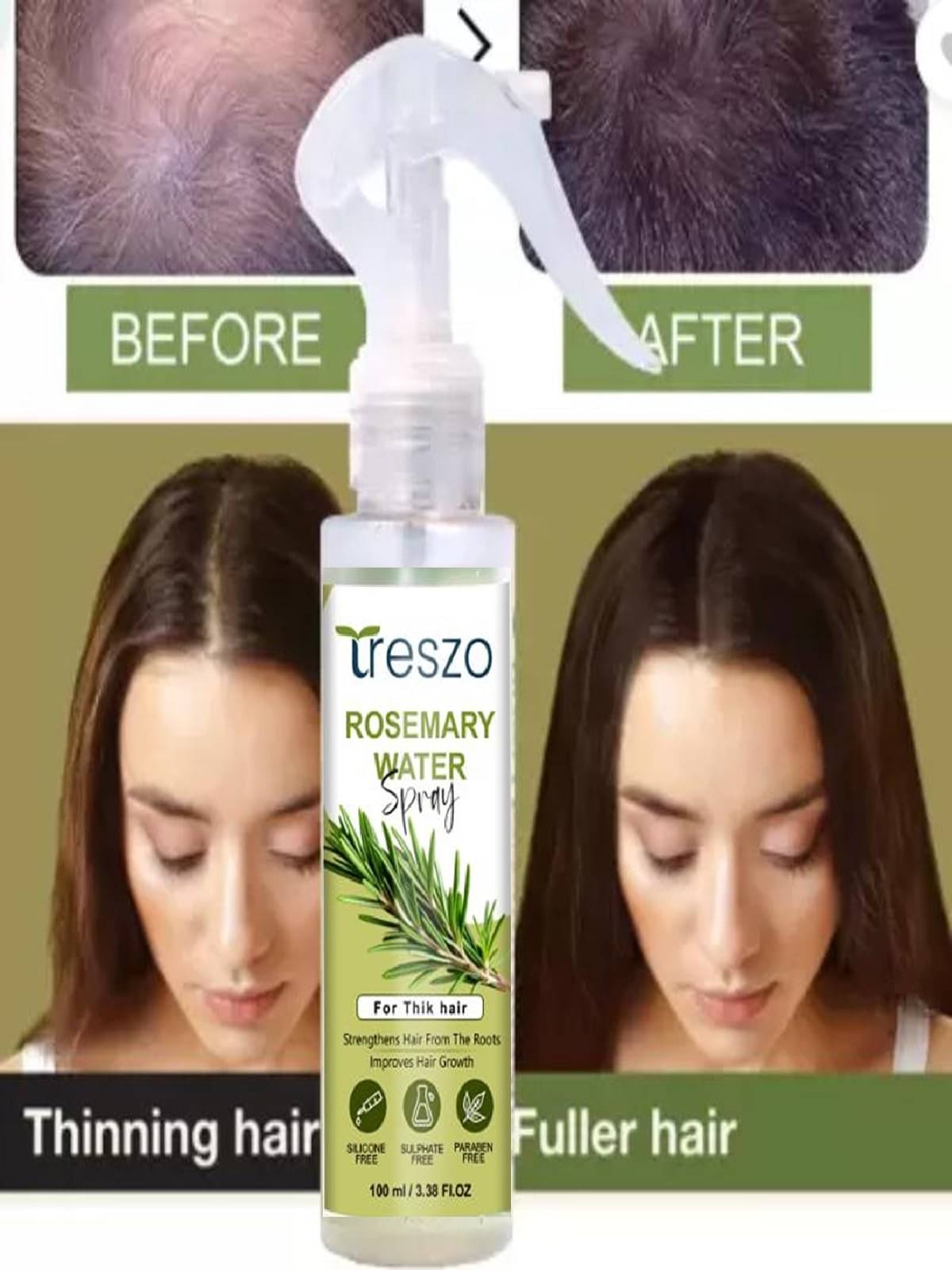     			Treszo Rosemary Hair Growth Hair Serum 100 mL