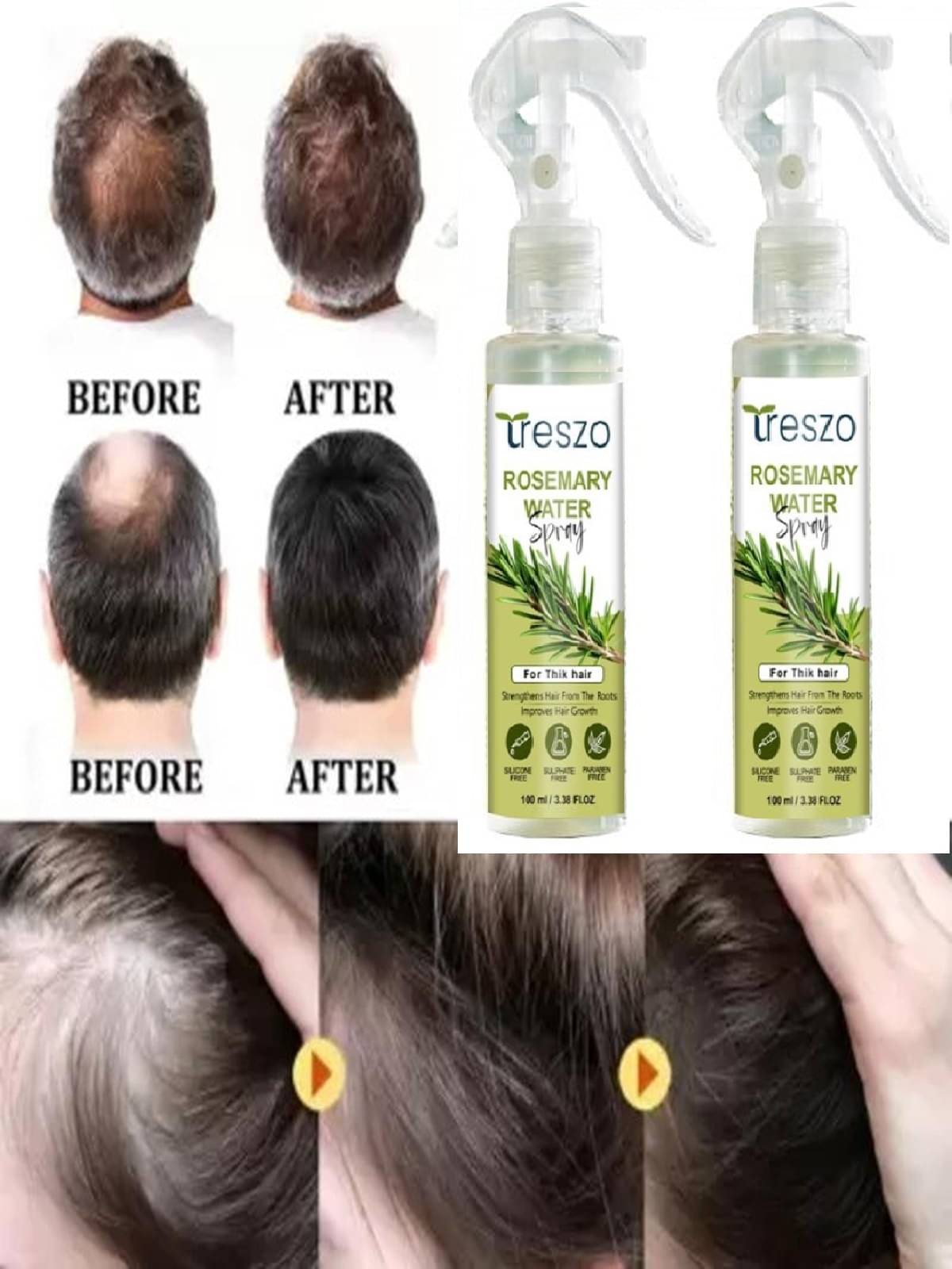 Treszo Rosemary Hair Growth Hair Serum 100 mL Pack of 2 Treszo Rosemary Hair Growth Hair Serum 100 mL Pack of 2