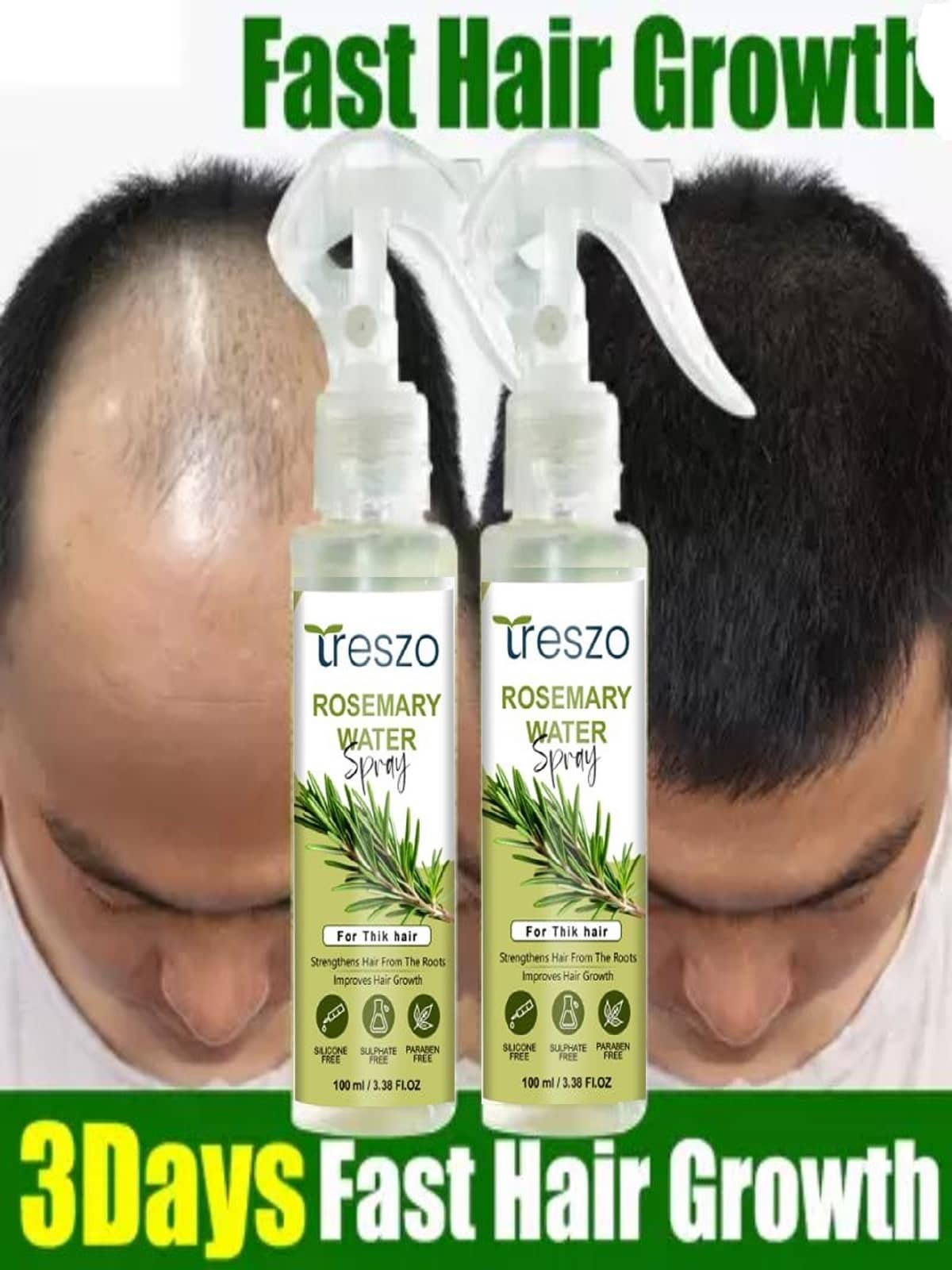 Treszo Rosemary Hair Growth Hair Serum 100 mL Pack of 2