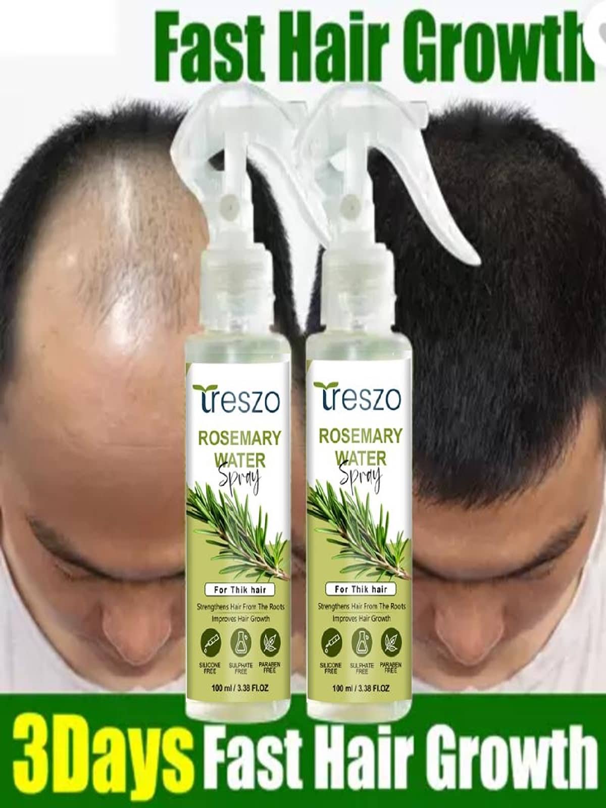 Treszo Rosemary Hair Growth Hair Serum 100 mL Pack of 2