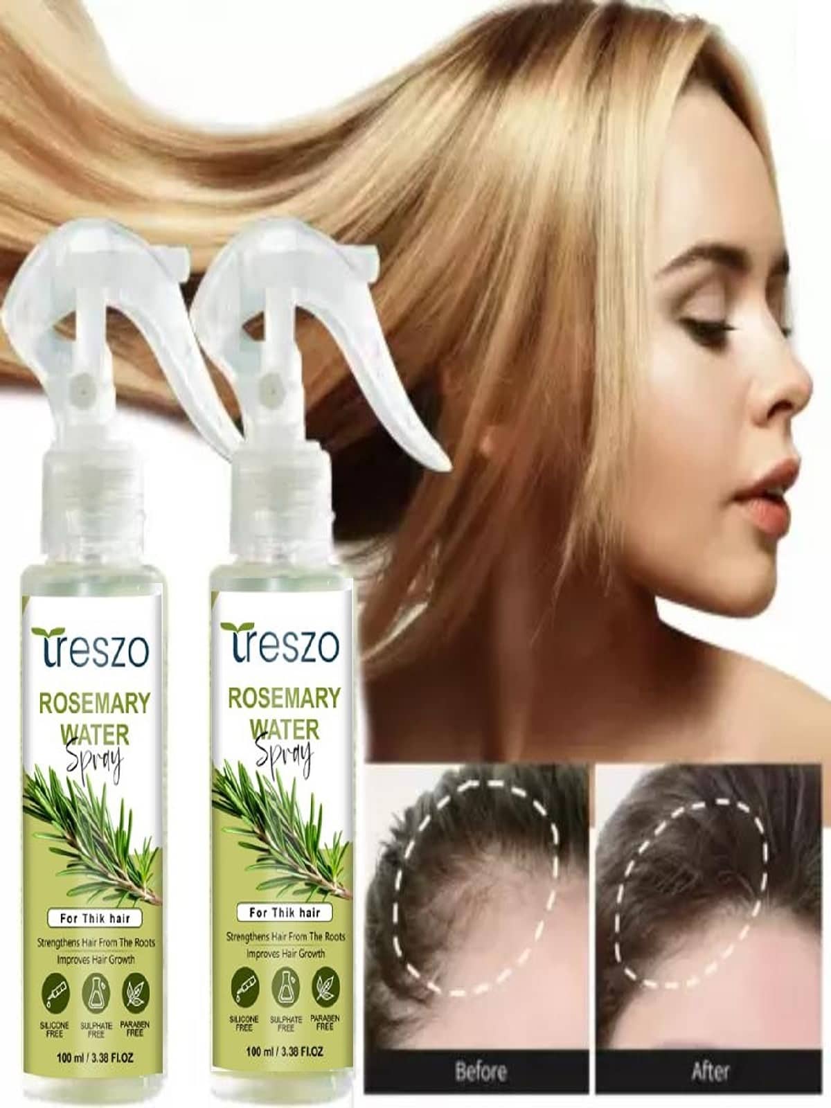 Treszo Rosemary Hair Growth Hair Serum 100 mL Pack of 2