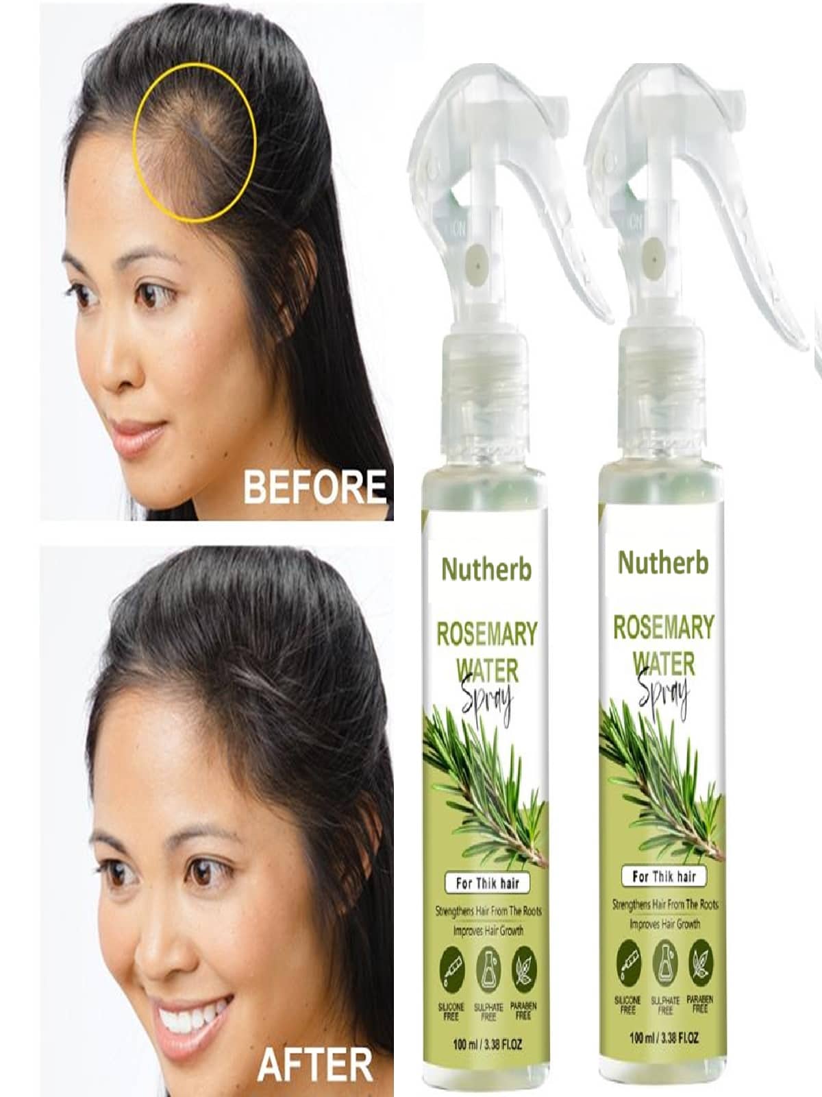 Treszo Rosemary Hair Growth Hair Serum 100 mL Pack of 2