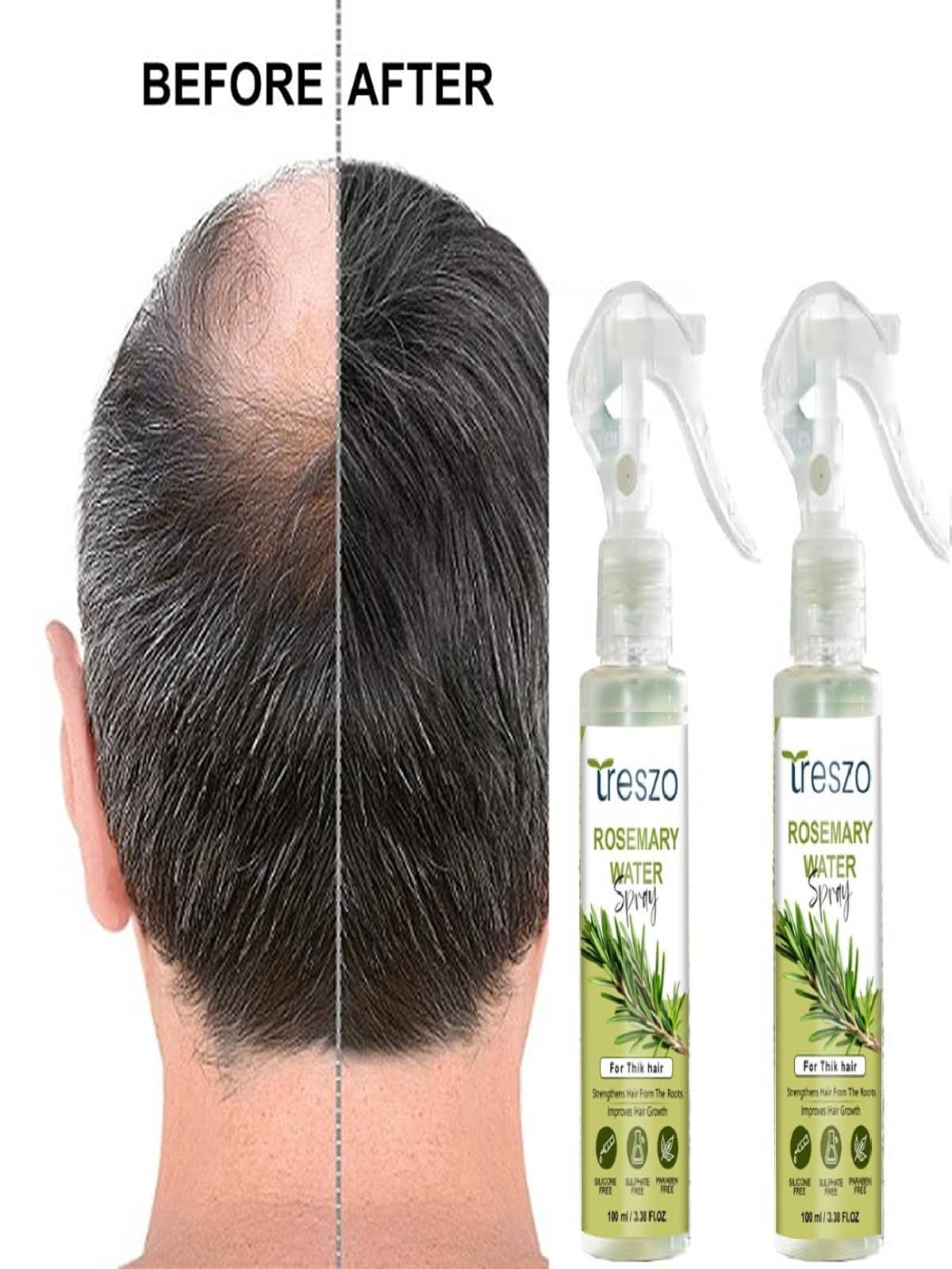 Treszo Rosemary Hair Growth Hair Serum 100 mL Pack of 2