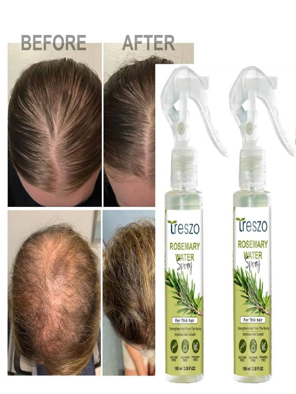Treszo Rosemary Hair Growth Hair Serum 100 mL Pack of 2