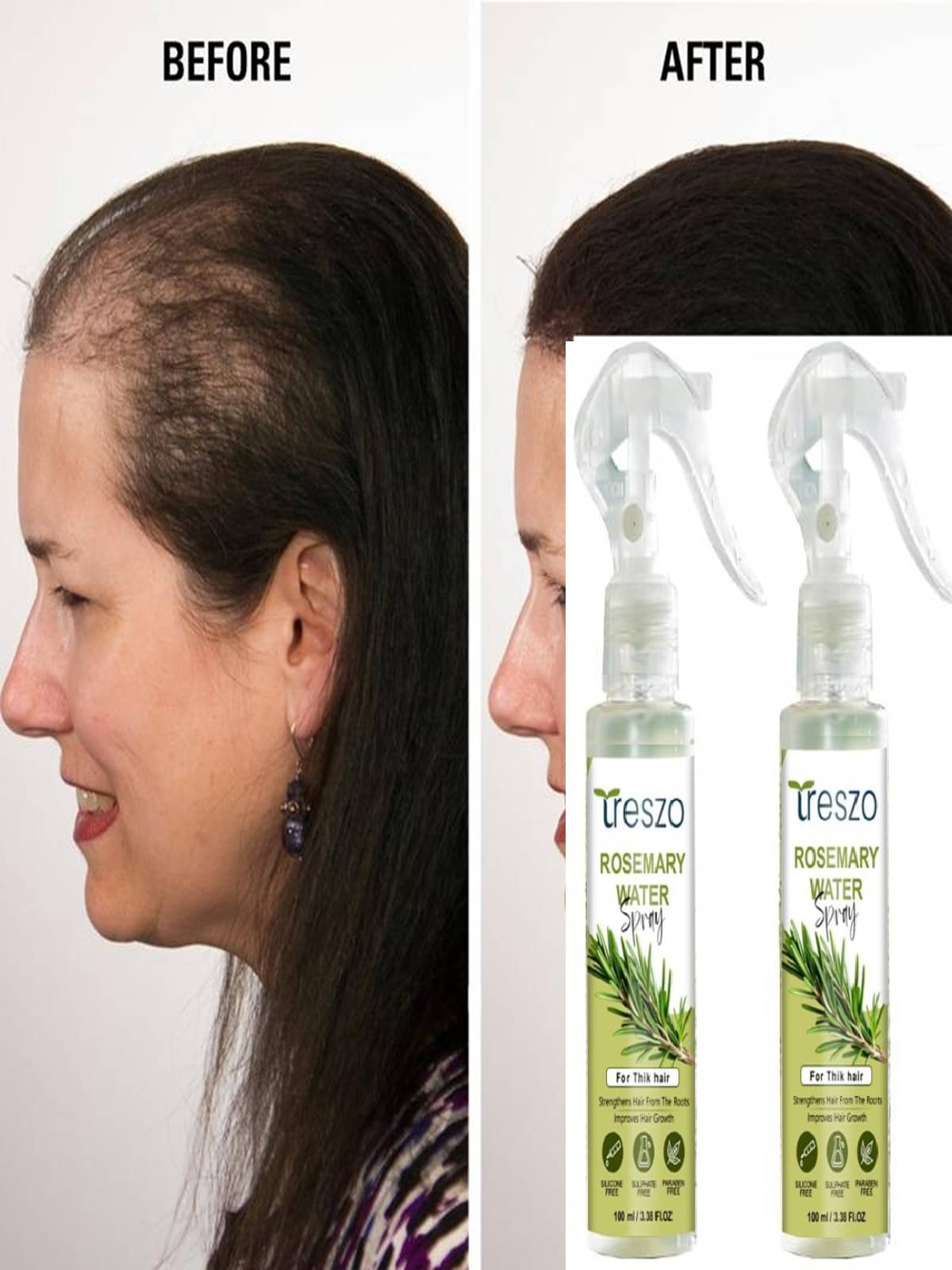 Treszo Rosemary Hair Growth Hair Serum 100 mL Pack of 2 Treszo Rosemary Hair Growth Hair Serum 100 mL Pack of 2