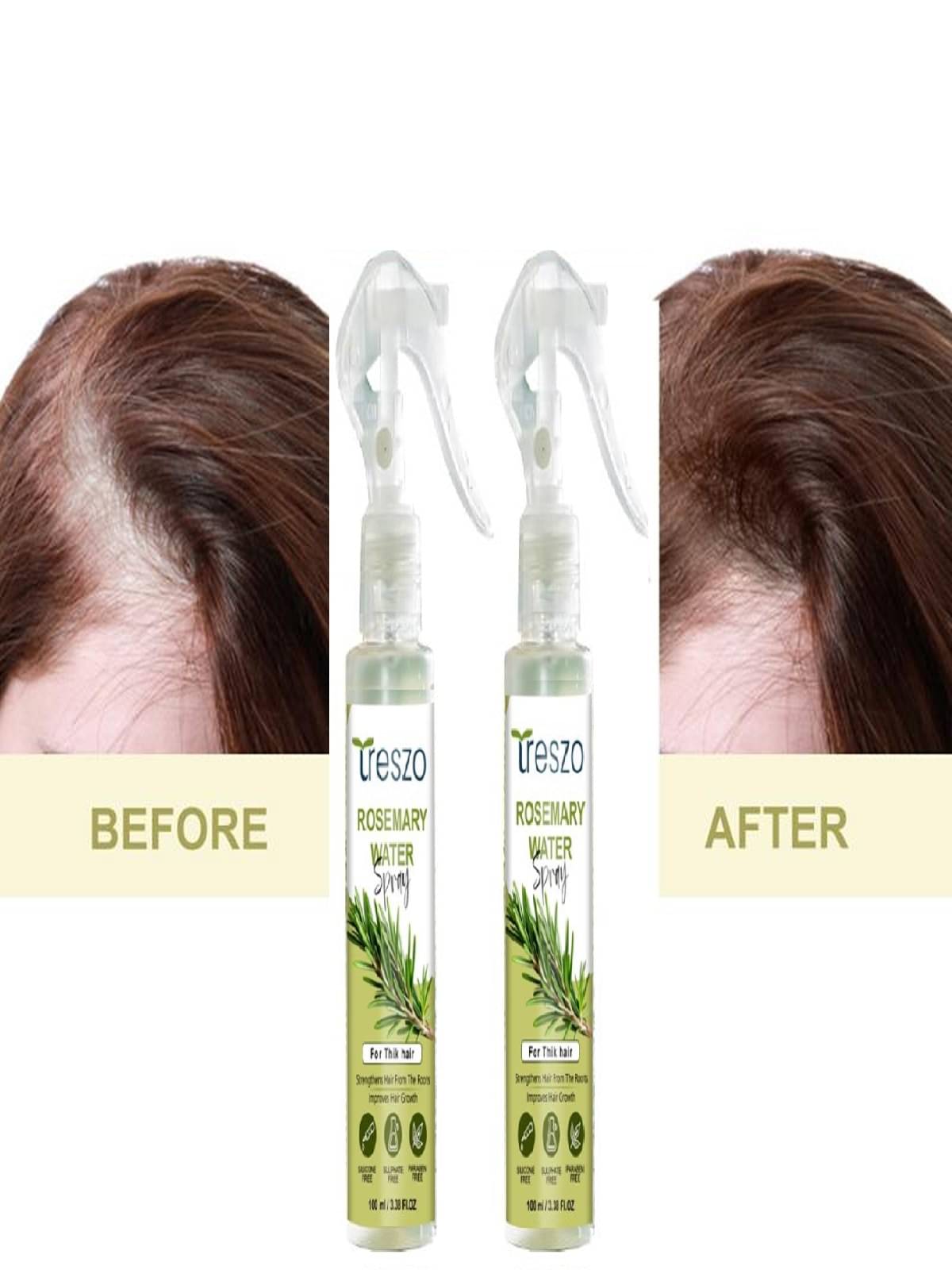 Treszo Rosemary Hair Growth Hair Serum 100 mL Pack of 2 Treszo Rosemary Hair Growth Hair Serum 100 mL Pack of 2