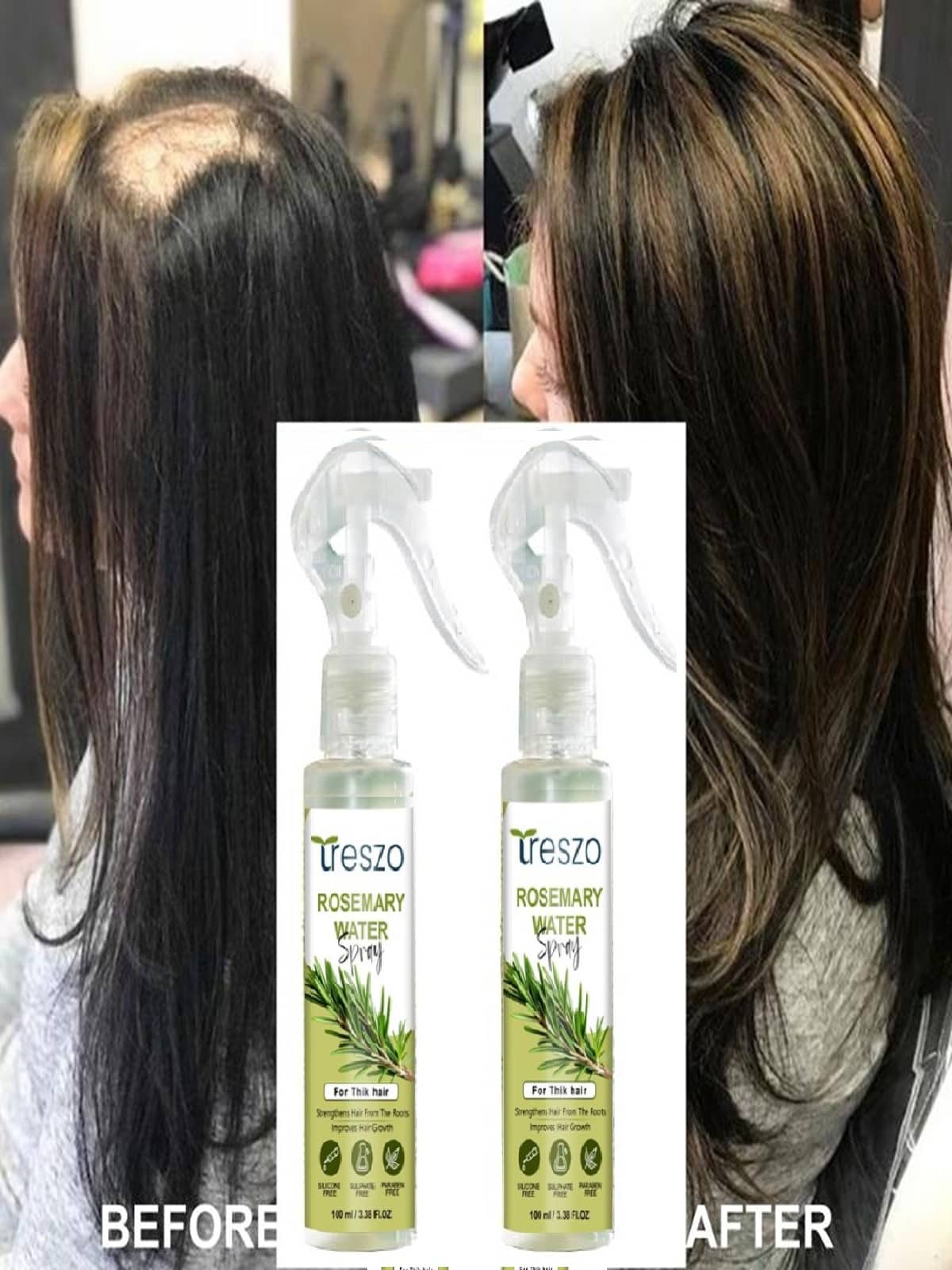 Treszo Rosemary Hair Growth Hair Serum 100 mL Pack of 2