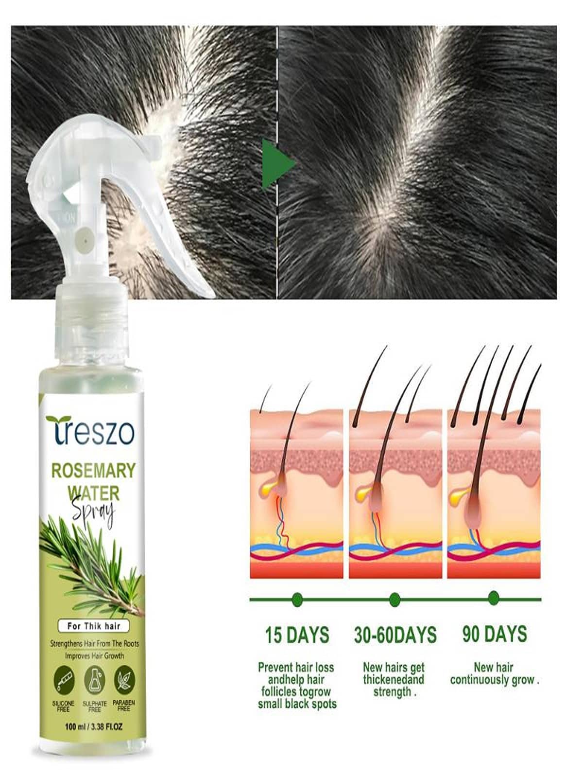 Treszo Rosemary Hair Growth Hair Serum 100 mL Pack of 2