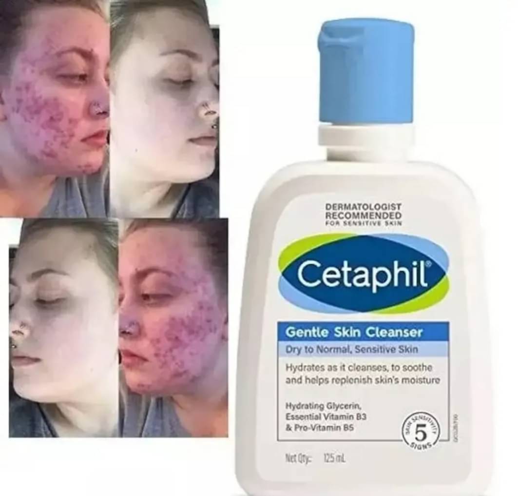     			Generic - Refreshing Face Cleanser For All Skin Type 1 g ( Pack of 1 )