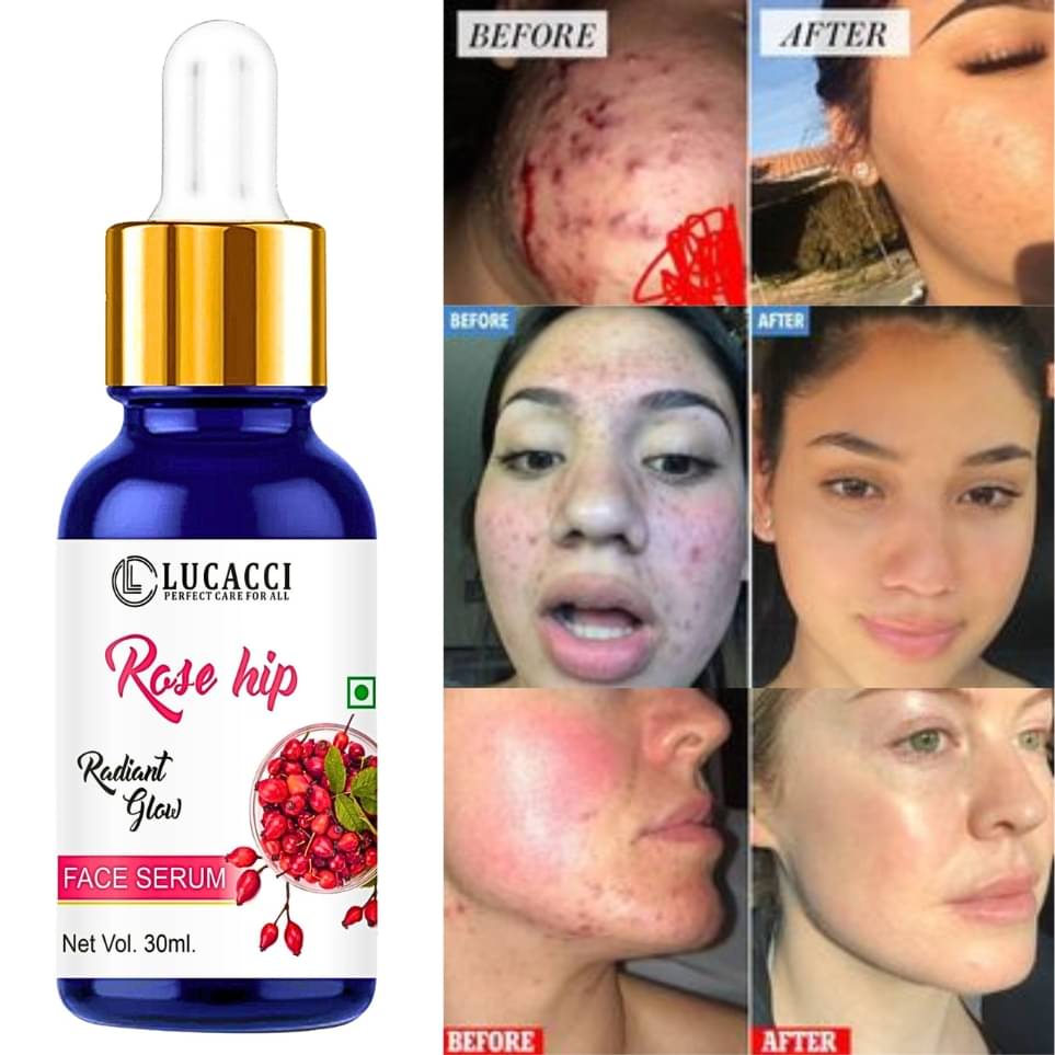     			LUCACCI Face Serum Vitamin E Pigmentation Reducing For All Skin Type ( Pack of 1 )