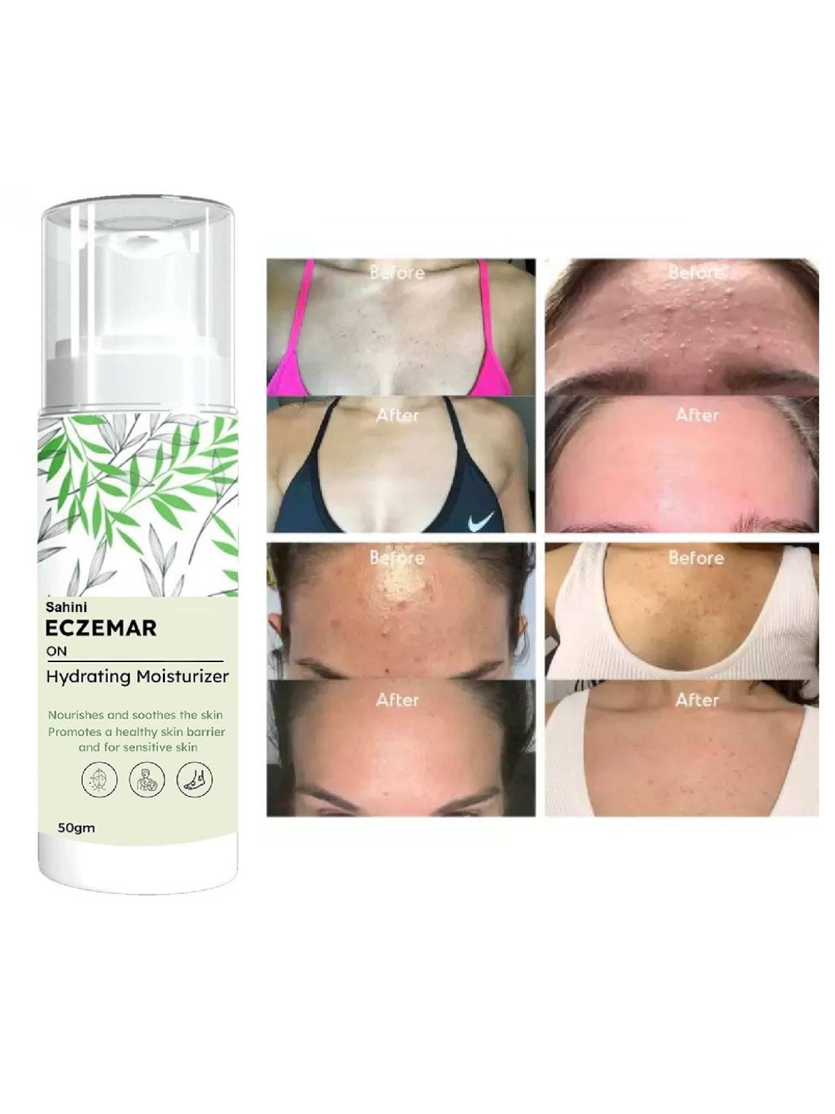     			Sahini Moisturizer All Skin Type Niacinamide ( 150gm gm )