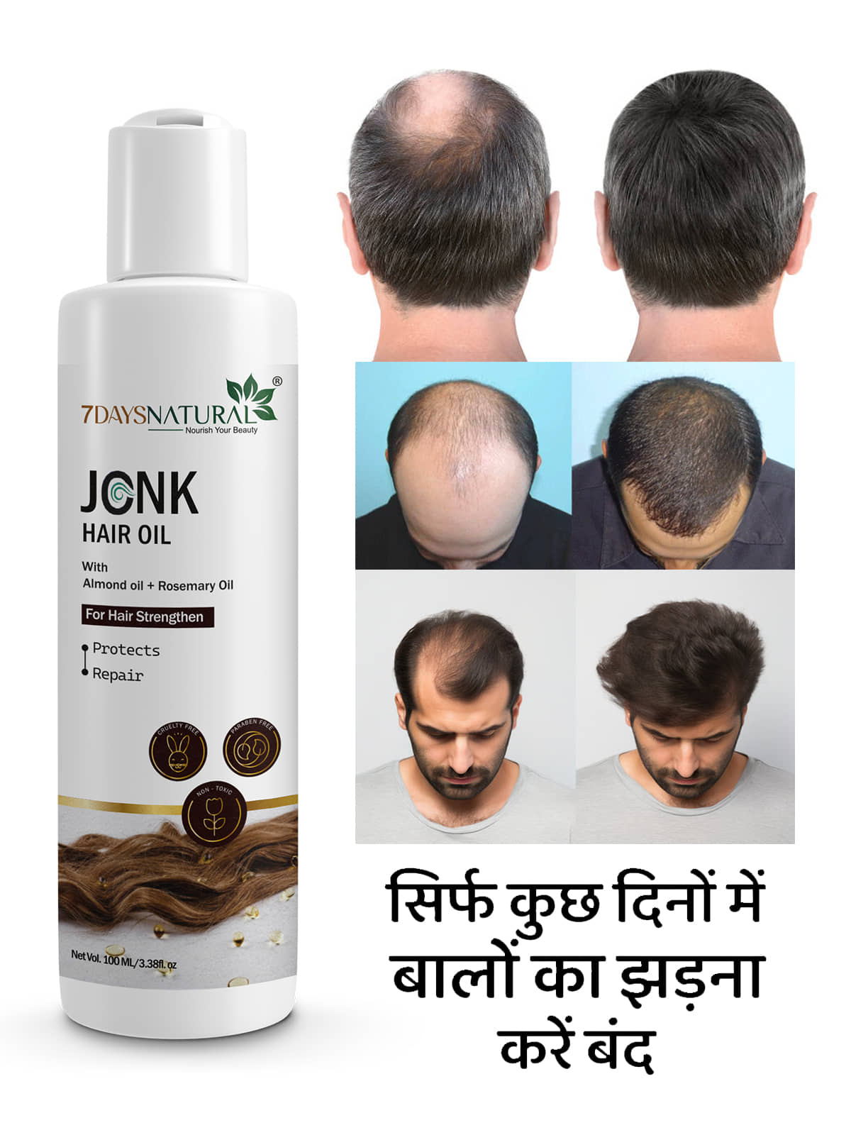 7 days Anti Hair Fall Onion Oil 120 ml ( Pack of 1 )