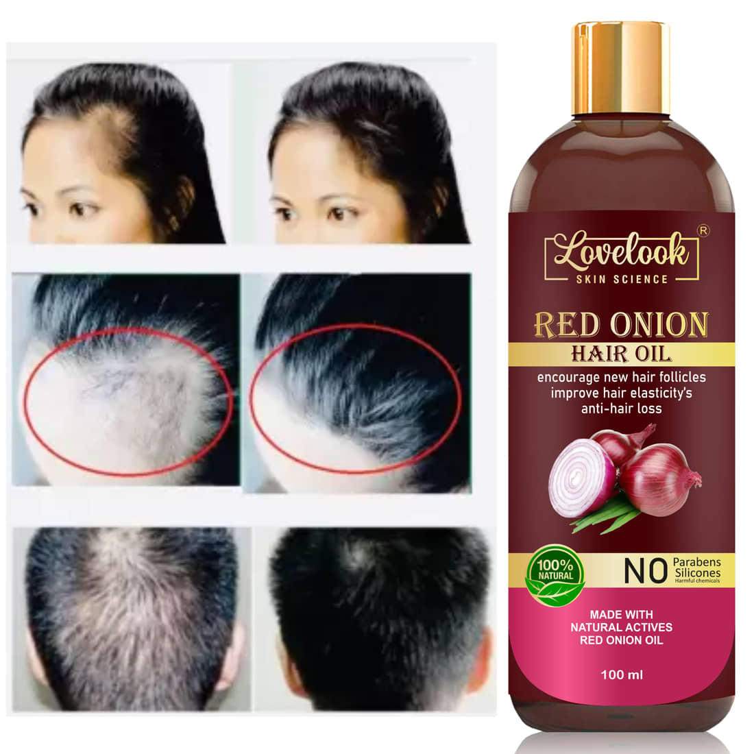 Lovelook - Anti Hair Fall Onion Oil 100 ml ( Pack of 1 )