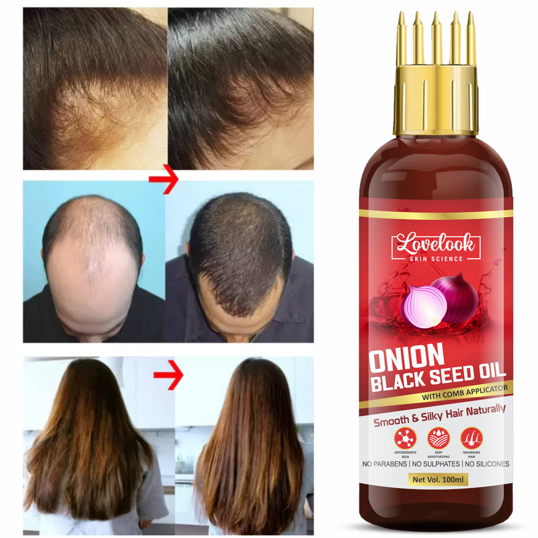 Lovelook - Damage & Repair Onion Oil 100 ml ( Pack of 1 )