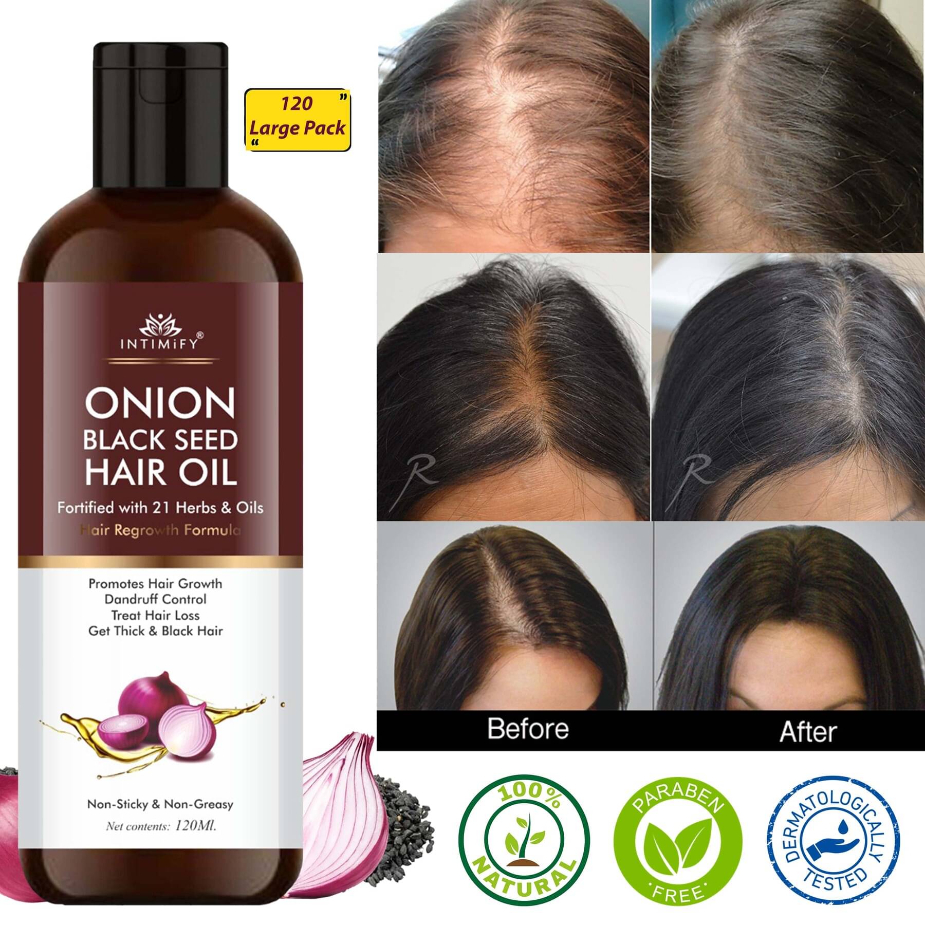     			Intimify Black Seed Onion Oil for Hair Growth 120 mL