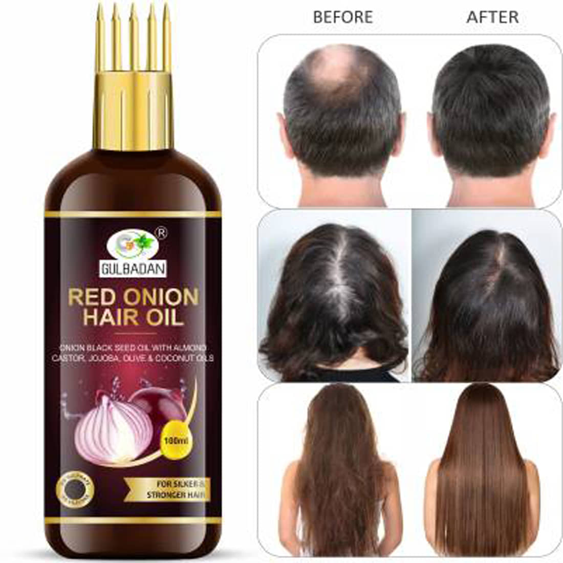 GULBADAN - Hair Growth Onion Oil 100 ml ( Pack of 1 )