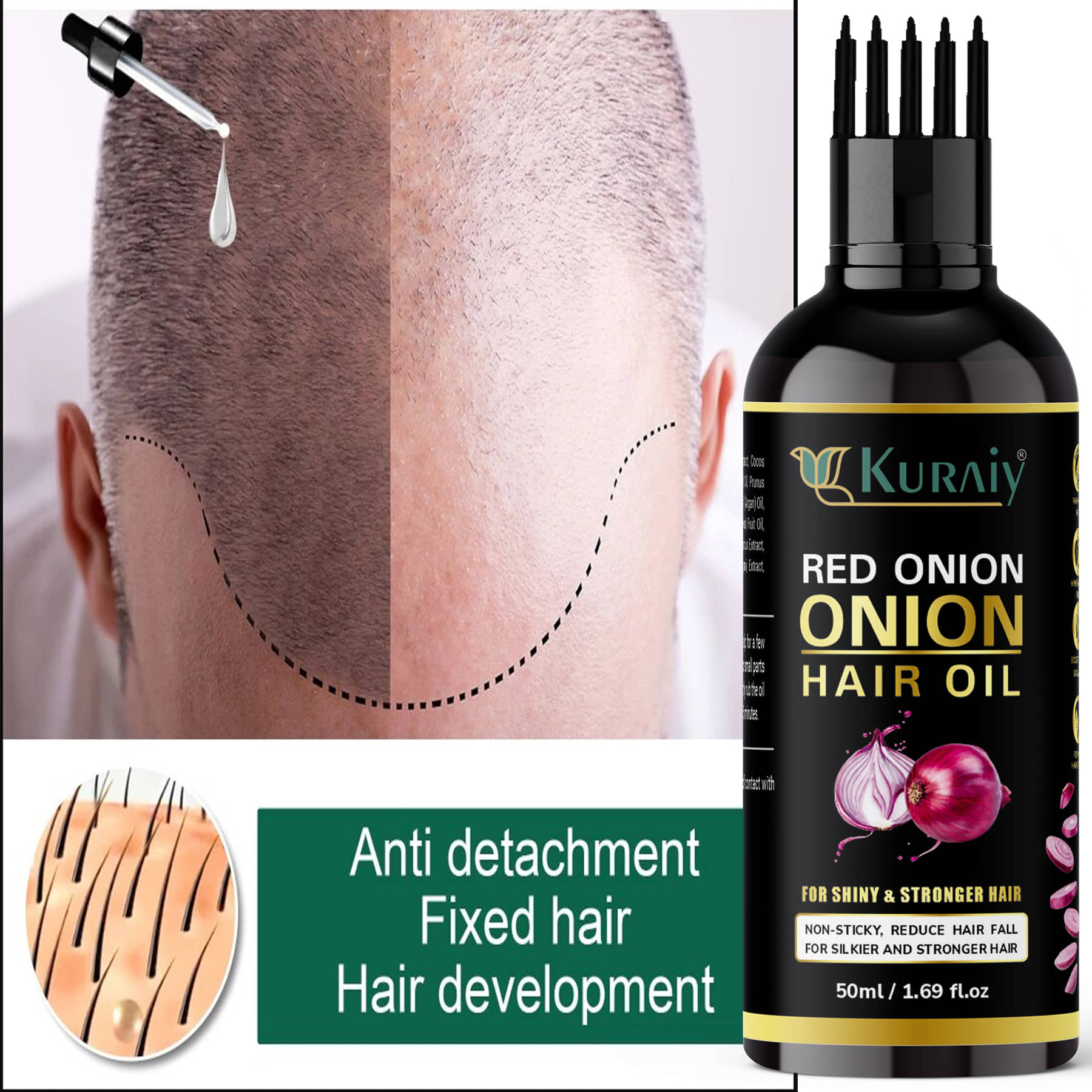 KURAIY ONION All Type of Hair Problem Herbal Anti Dandruff Hair Oil 50 ML Hair Oil PACK OF 1