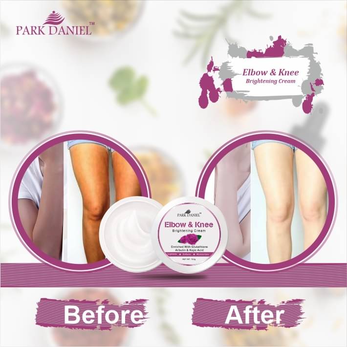 Park Daniel Elbow and Knee Skin Whitening Cream to Remove Dark Spots Pack of 1 of 100 Grams Park Daniel Elbow and Knee Skin Whitening Cream to Remove Dark Spots Pack of 1 of 100 Grams