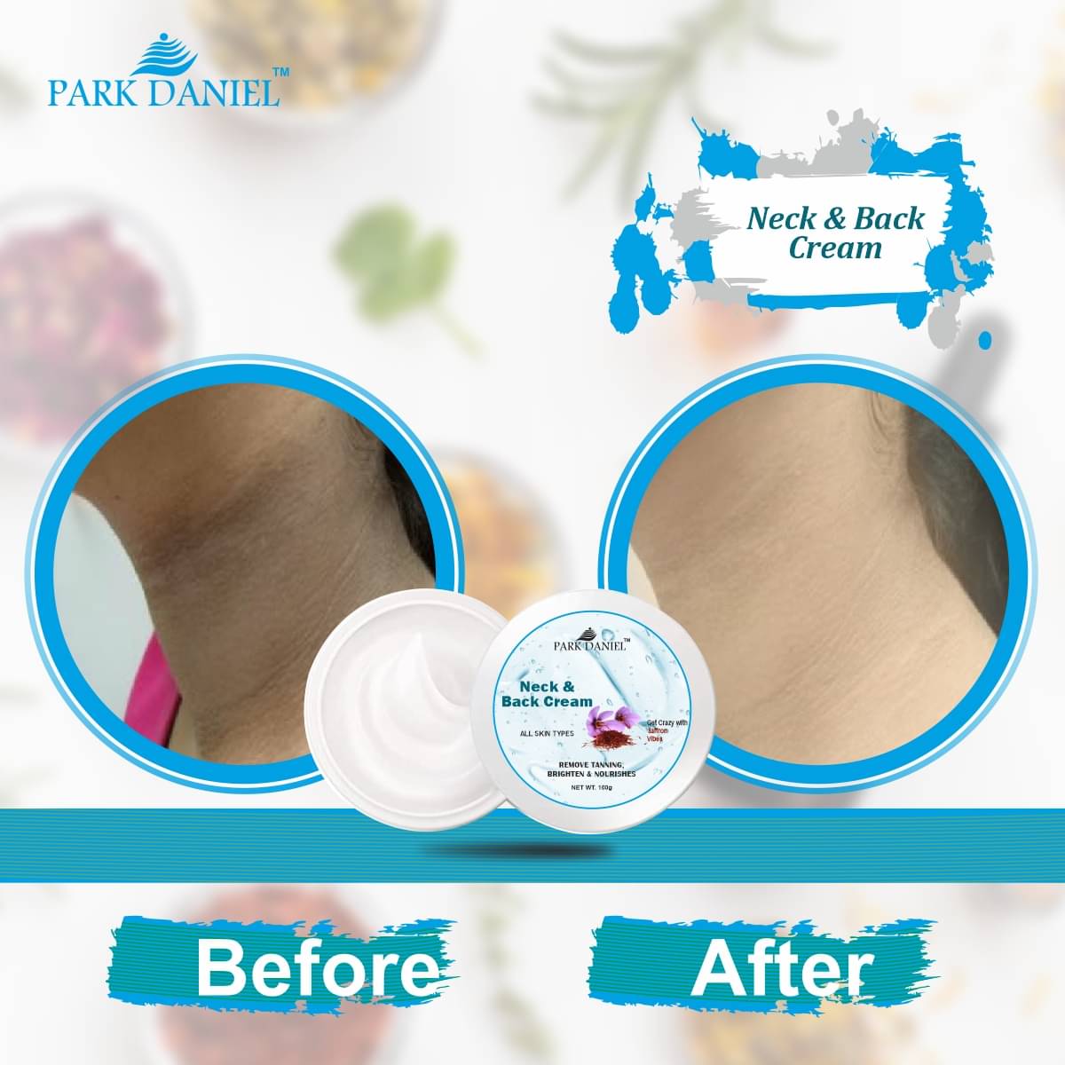 Park Daniel Neck & Back Whitening Cream For All Skin Types Pack of 1 of 100 Grams     			Park Daniel Neck & Back Whitening Cream For All Skin Types Pack of 1 of 100 Grams