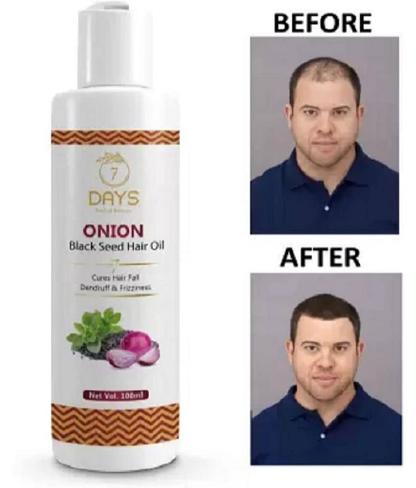7 days - Hair Growth Onion Oil 100 ml ( Pack of 1 )