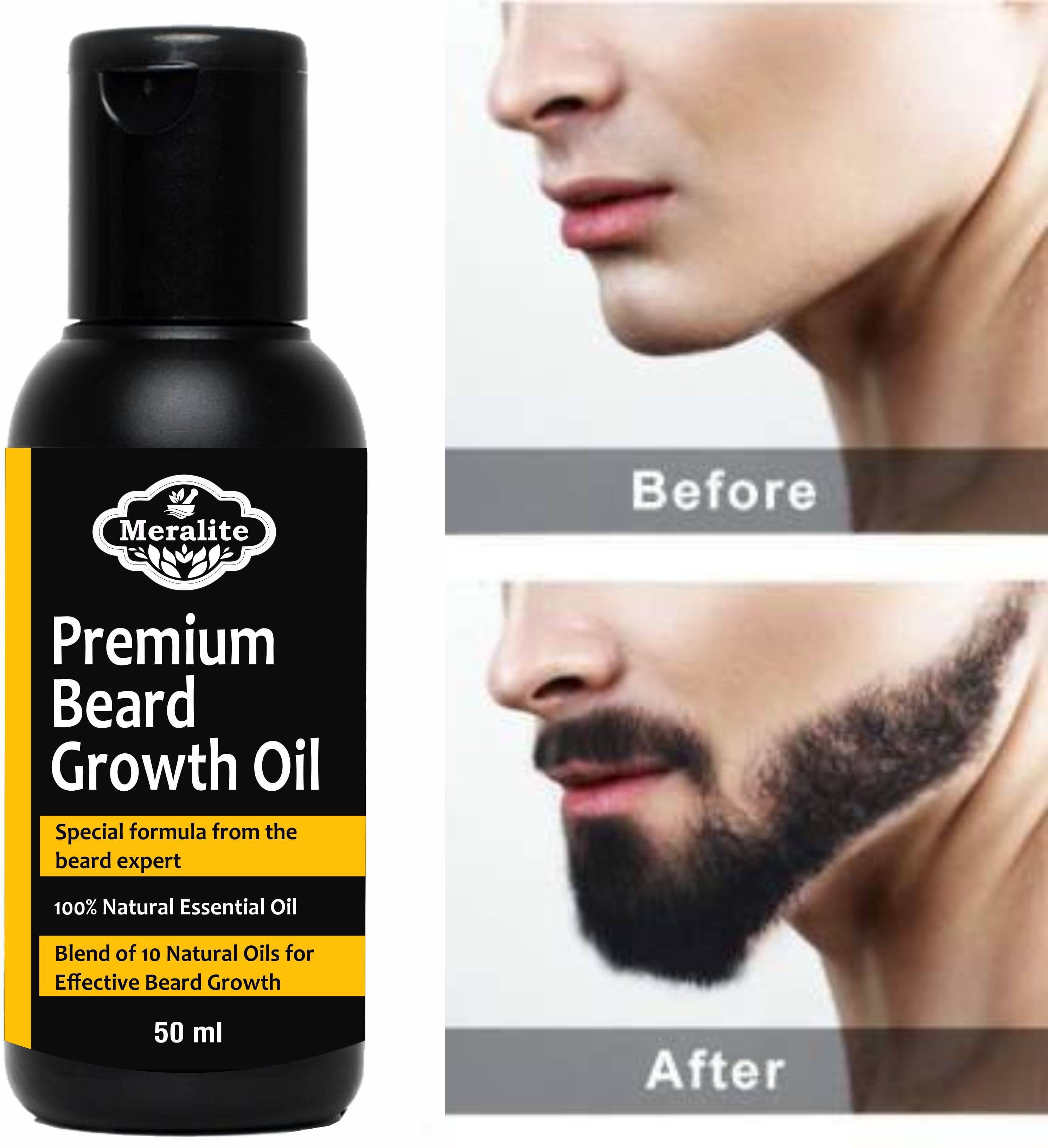MERALITE - 50mL Promotes Beard Growth Beard Oil ( Pack of 1 ) MERALITE - 50mL Promotes Beard Growth Beard Oil ( Pack of 1 )