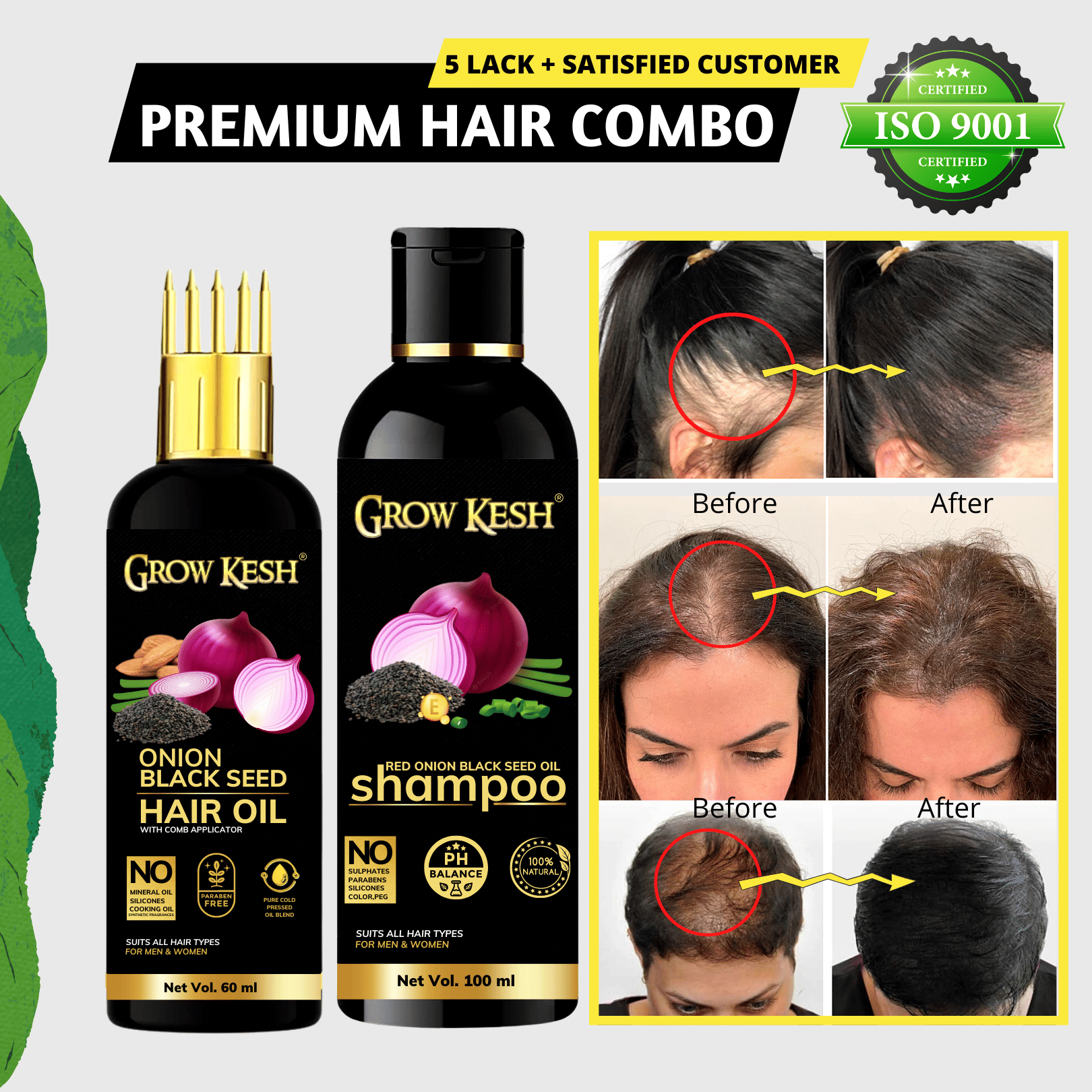 Growkesh Onion Hair Oil for Hair Regrowth and Hair Fall Control with Blackseed with Comb Applicator and Red Onion Shampoo for Anti-dundruff (Onion Hair oil,60ml + Onion Shampoo,100ml)