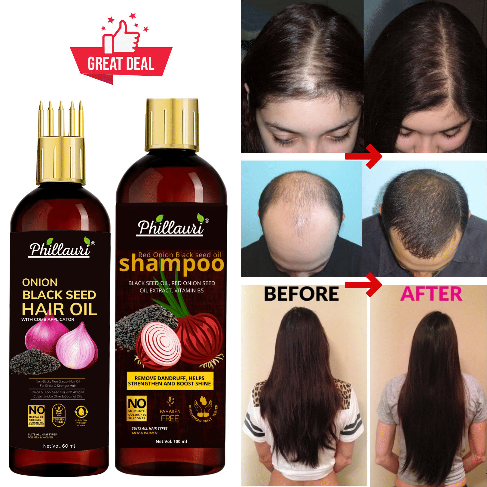 Phillauri Anti Hair Fall Onion Hair Oil (60 ML)+ Onion Shampoo (100 ML) for Hair Fall Control"  (2 Items in the set)