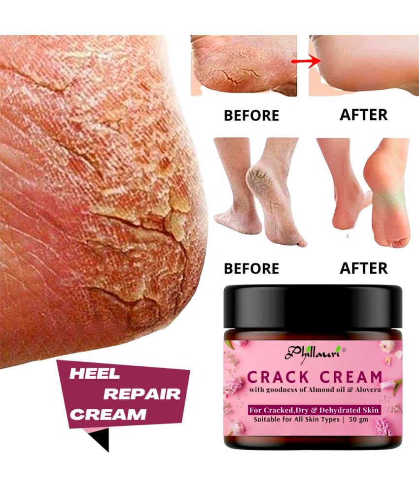 Phillauri Foot Cracked Repair Cream For Healing & Soothing Of Cracked Heels ( 50gm)