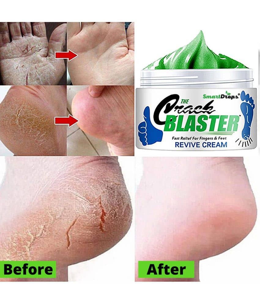 Smartdrops Smartdrops Foot Cream SPF 24 ( 150 g )