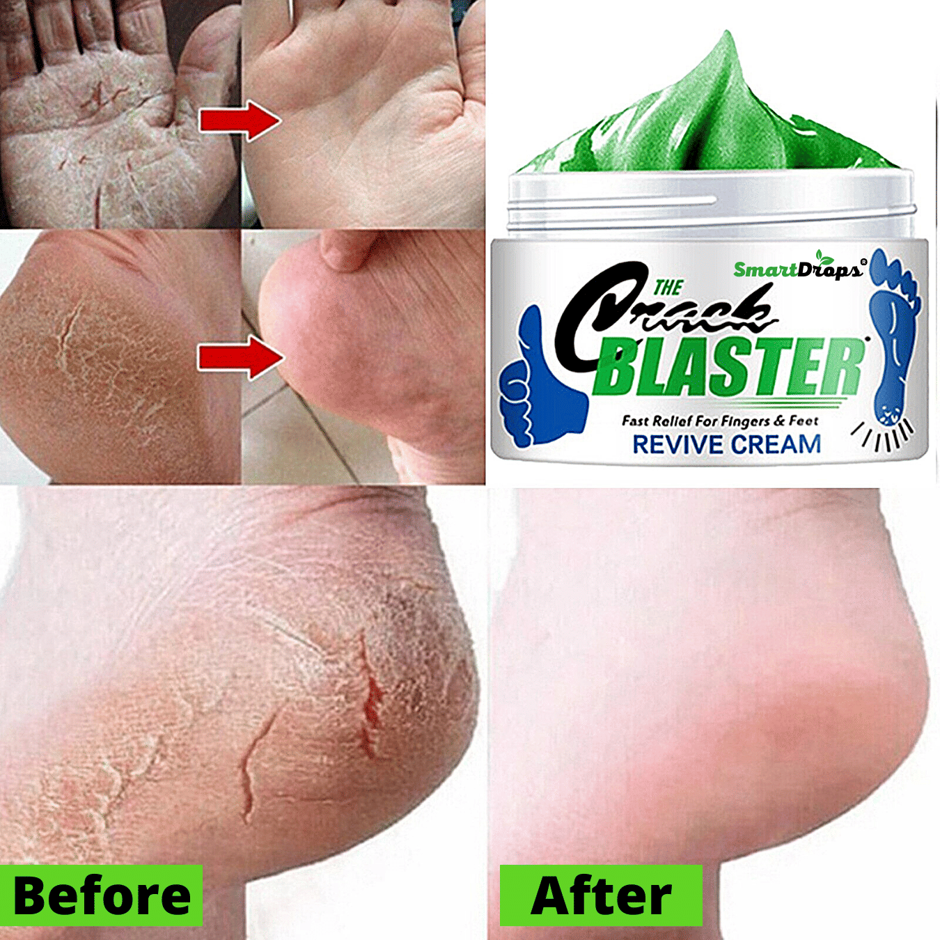 Smartdrops Smartdrops Foot Cream SPF 24 ( 150 g )