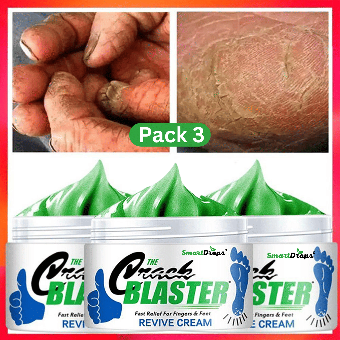 Smartdrops Cracked skin repair Cream for All year ( 50 g )