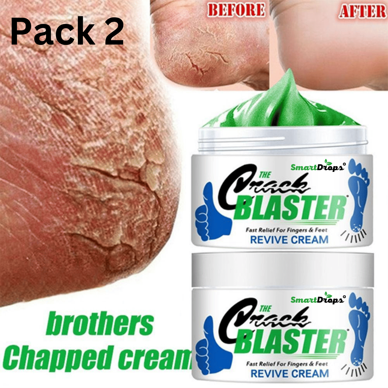 Smartdrops Cracked skin repair Cream for All year ( 50 g )