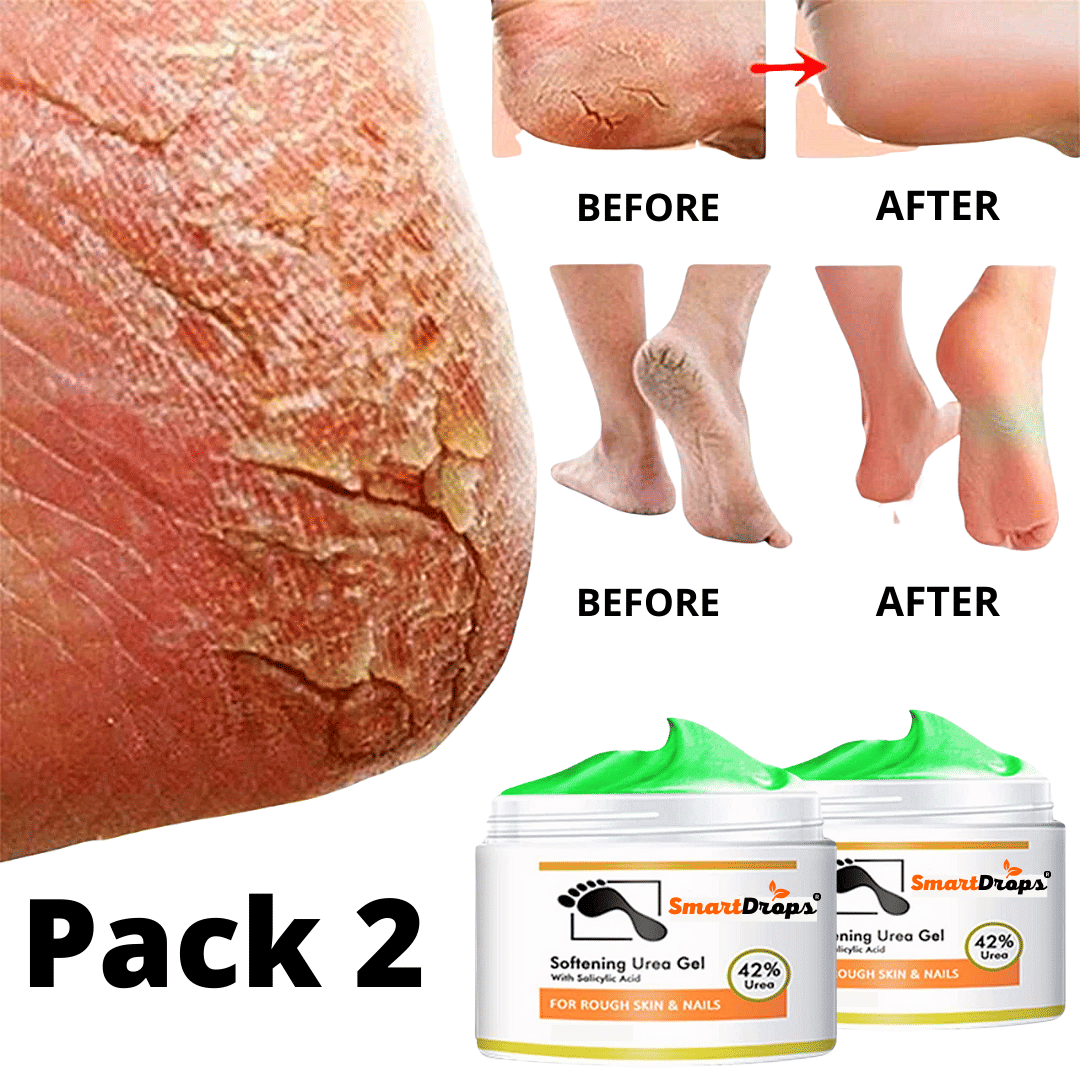 Smartdrops Chapped Hand And Foot Cream Crack Peeling Repair Anti Dry Skin Remove Dead Skin Foot Moisturizing (50gm) Pack of 2