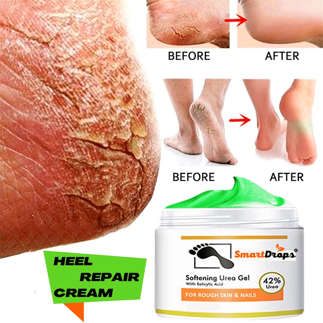     			Smartdrops Chapped Hand And Foot Cream Crack Peeling Repair Anti Dry Skin Remove Dead Skin Foot Moisturizing (50gm) Pack of 1
