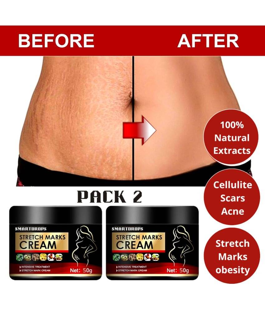 Smartdrops Pragnancy Stretch Mark Remove Cream Shaping & Firming Cream 50 g - Pack of 2 Smartdrops Pragnancy Stretch Mark Remove Cream Shaping & Firming Cream 50 g - Pack of 2