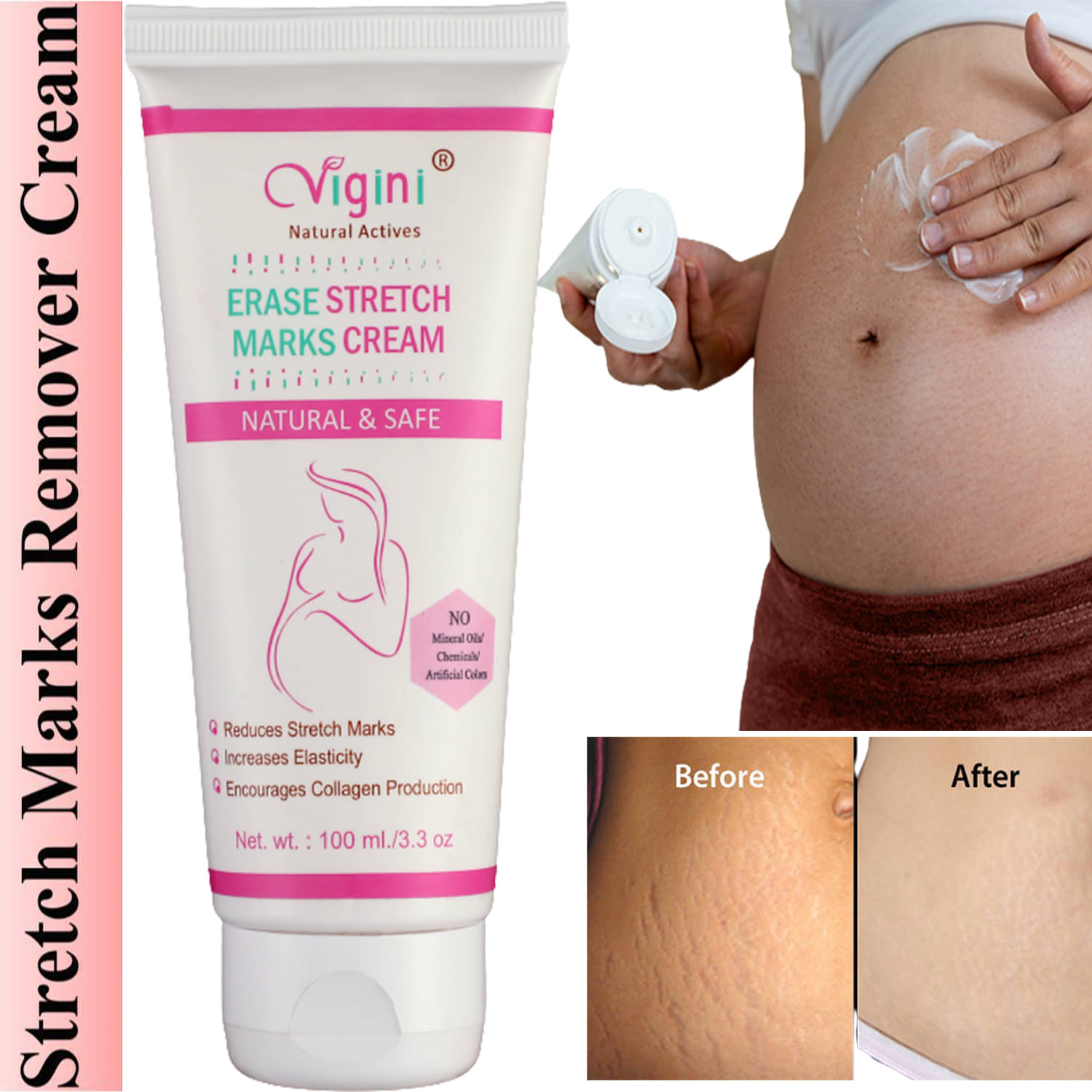     			Vigini Natural Stretch Marks Removal Cream for Skin Tightening Shaping & Firming Cream 100 g