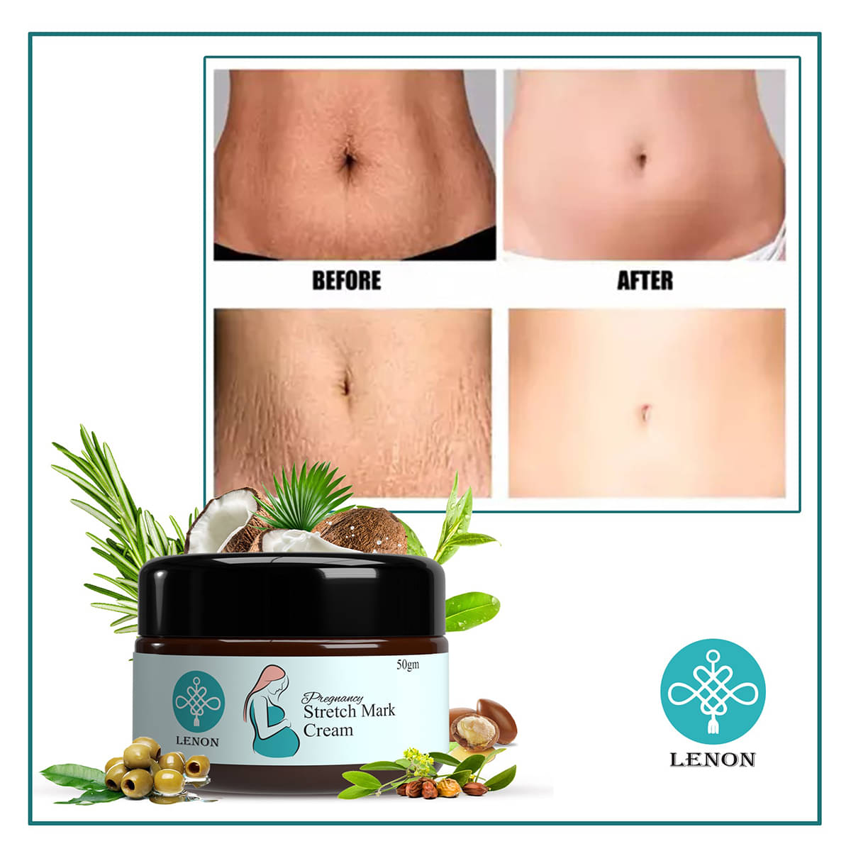     			Lenon Premium Stretch Mark Shaping & Firming Cream 50 g
