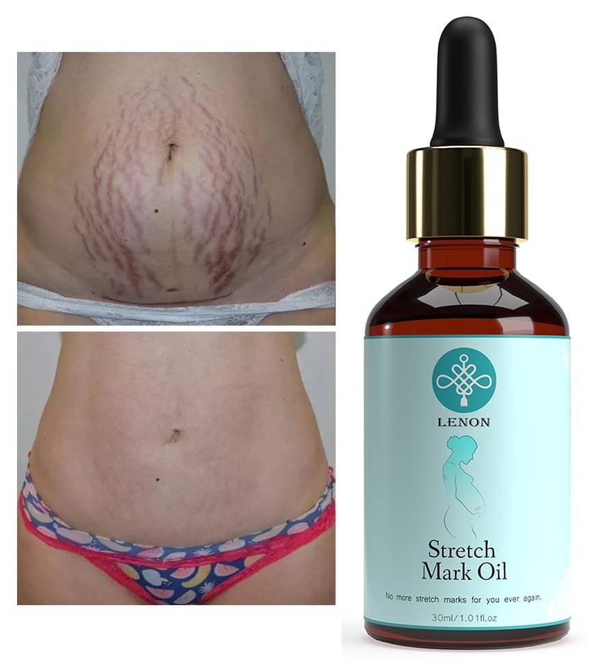     			Lenon Stretch Mark Oil Shaping & Firming Oil 10 mL